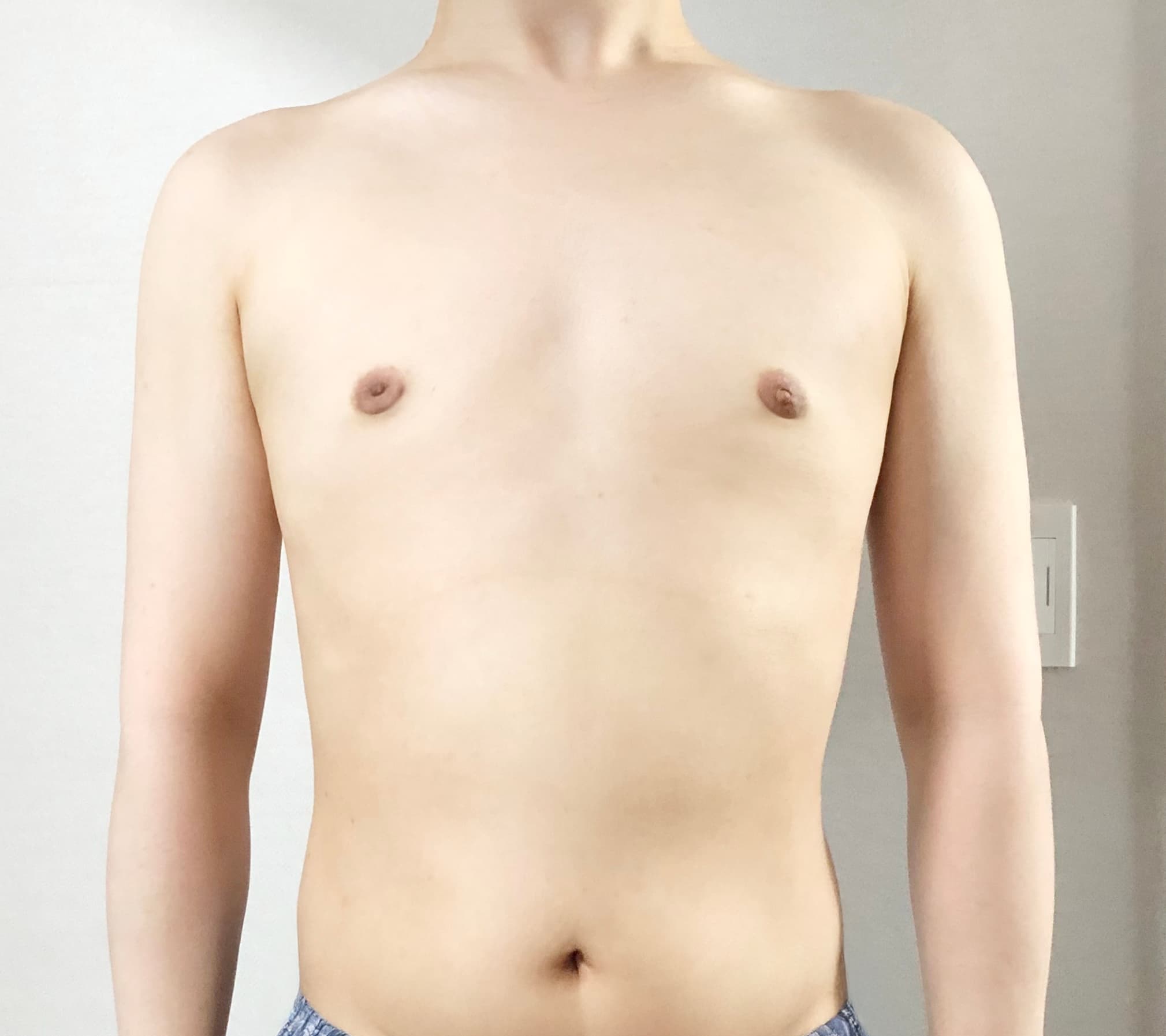 라랄르라님의 시술후기