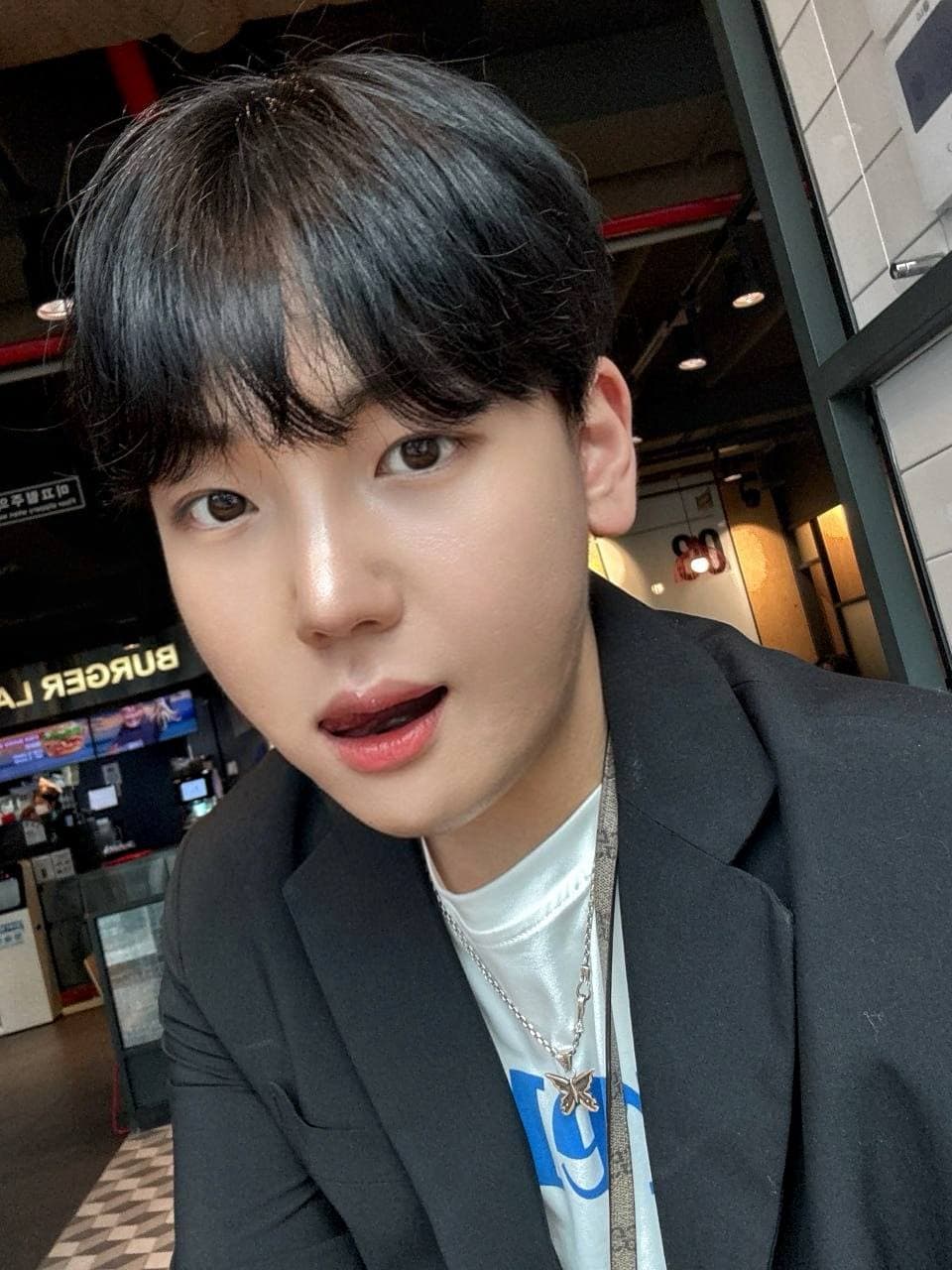 이브븡님의 시술후기