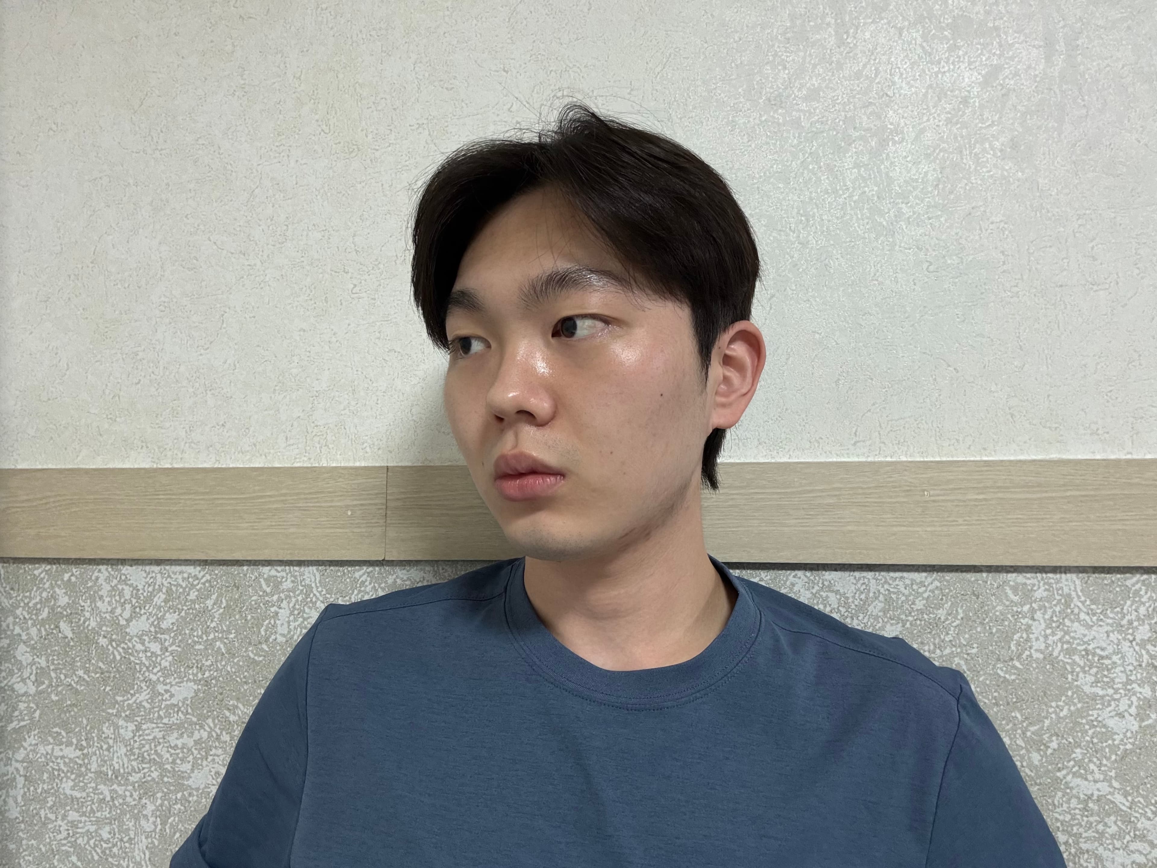 칠팔구장이님의 시술후기