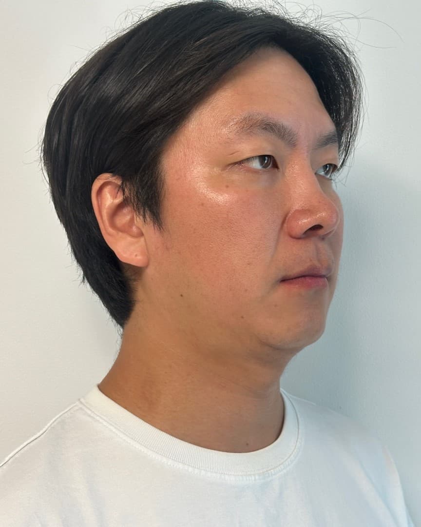 이쑤님의 시술후기