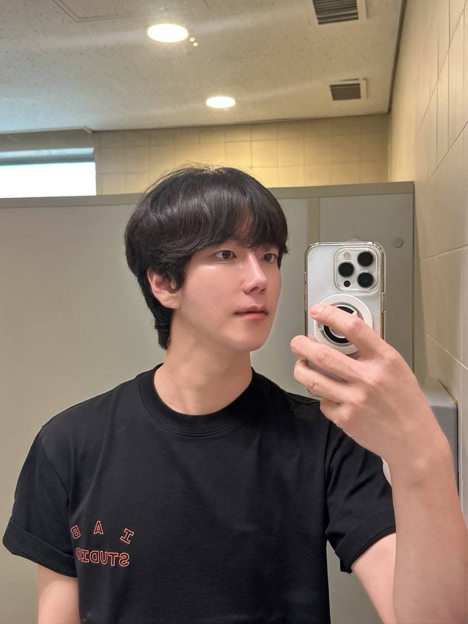 이쑤님의 시술후기