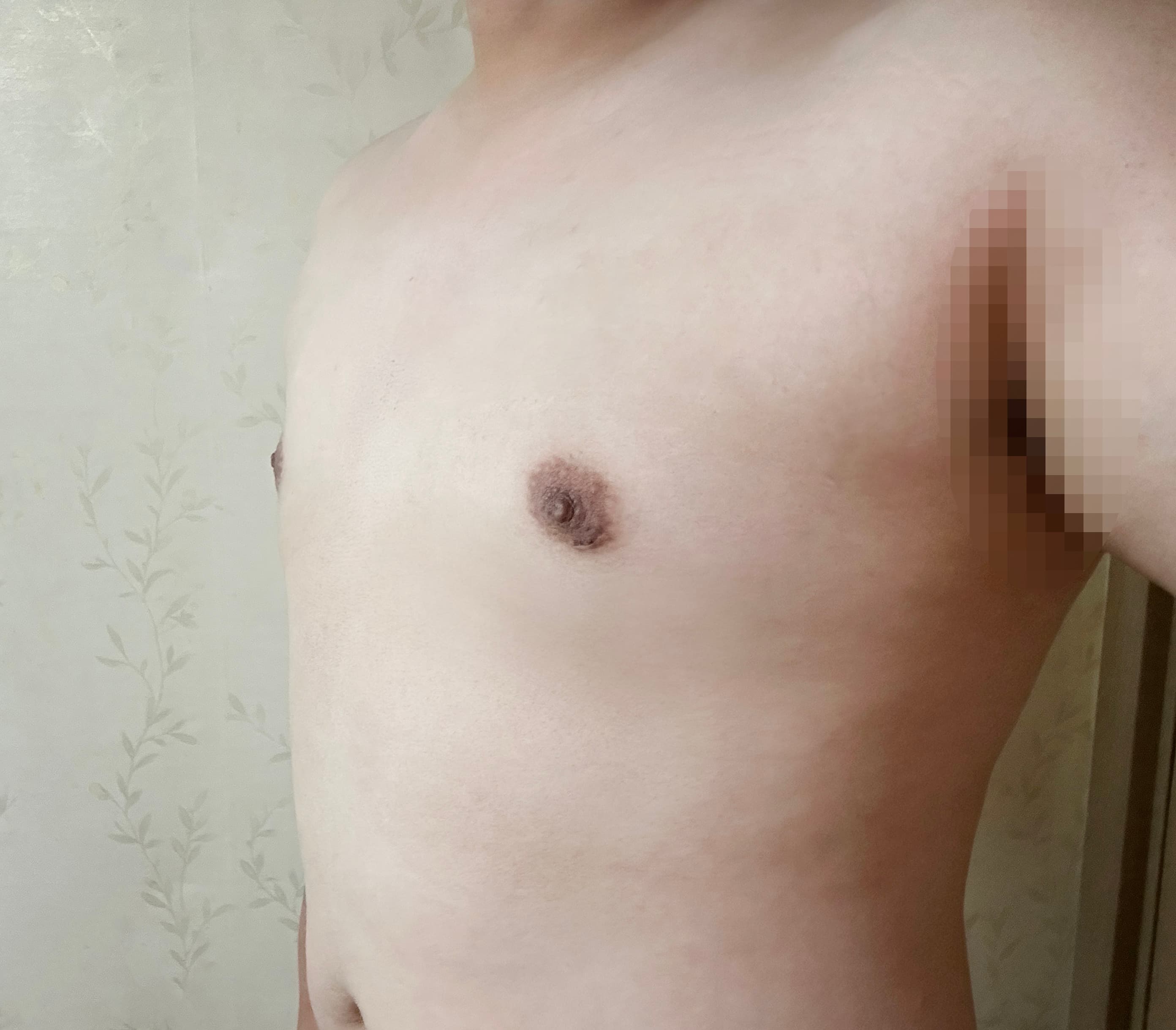 클쑤마쑹님의 시술후기