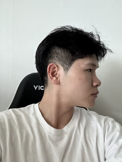 다르바르님의 시술후기