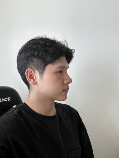 다르바르님의 시술후기