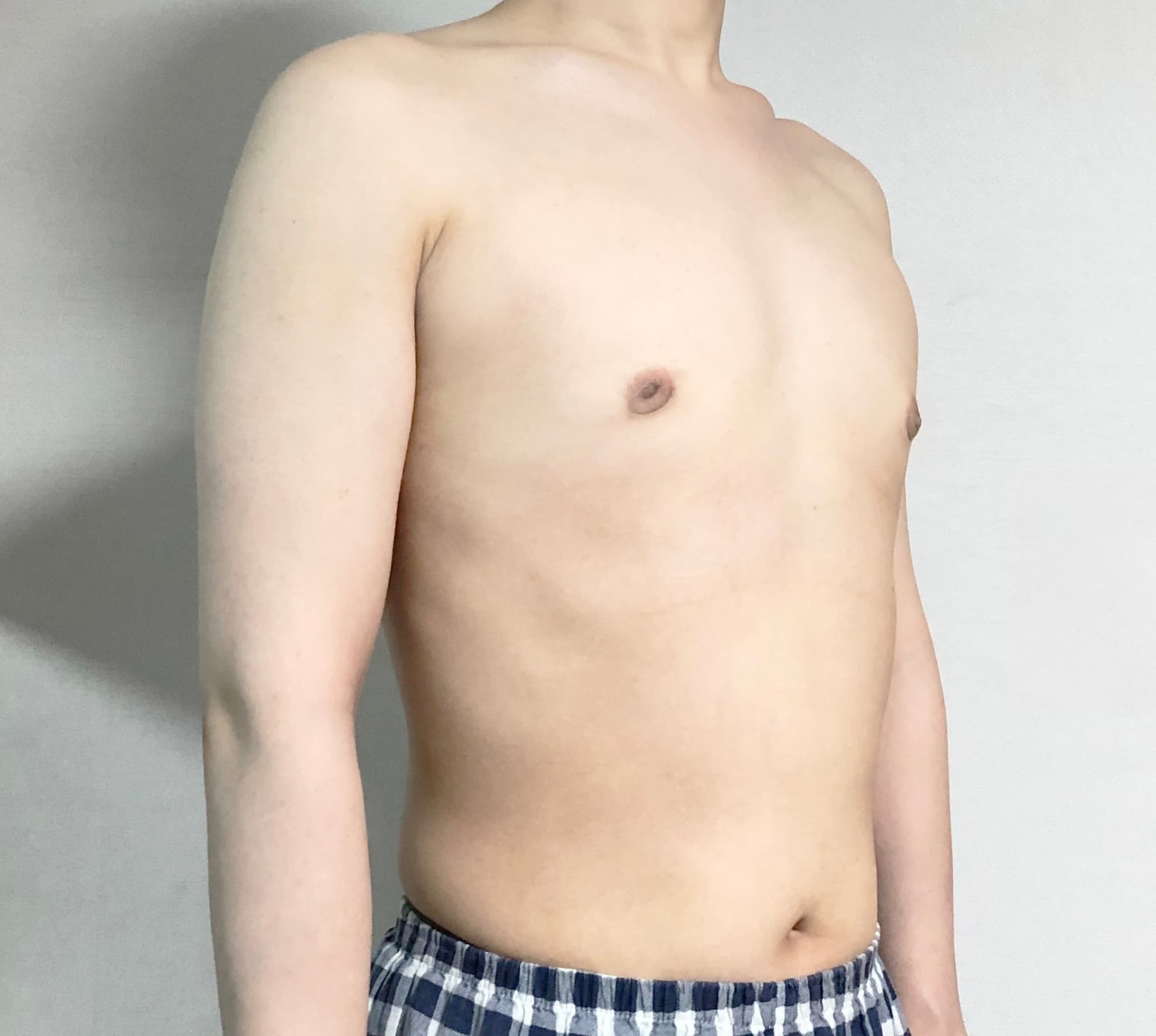 라랄르라님의 시술후기