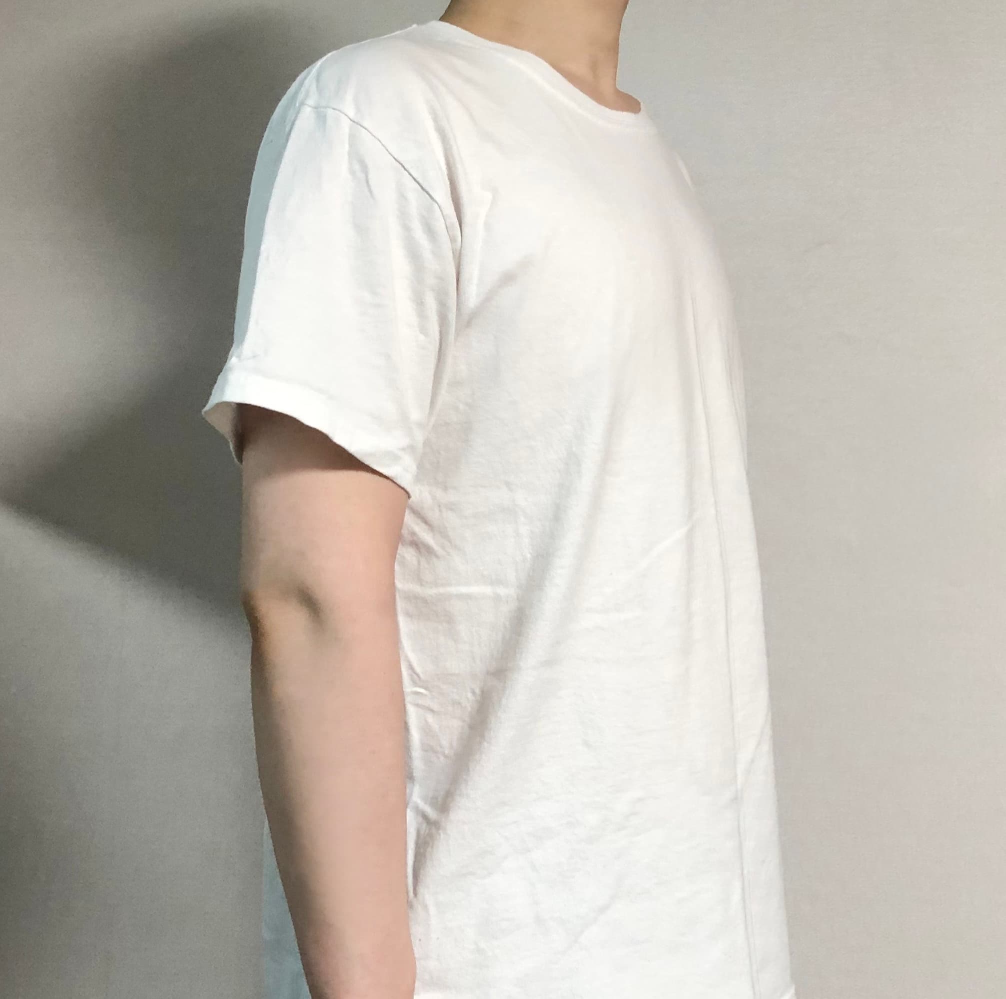 라랄르라님의 시술후기