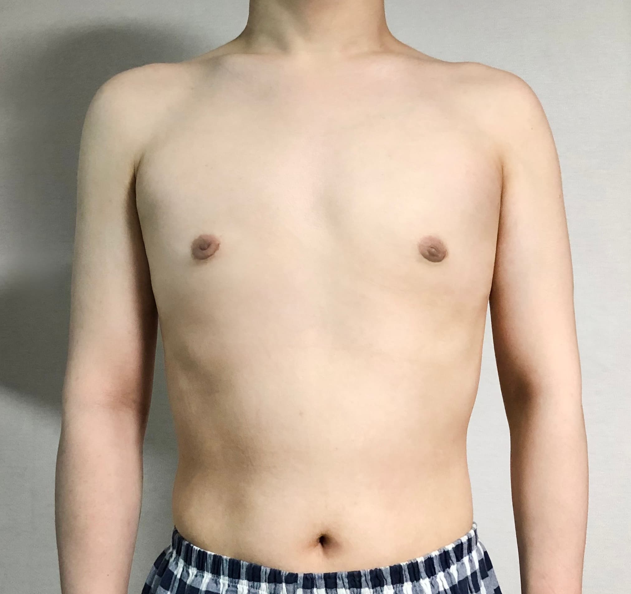 라랄르라님의 시술후기