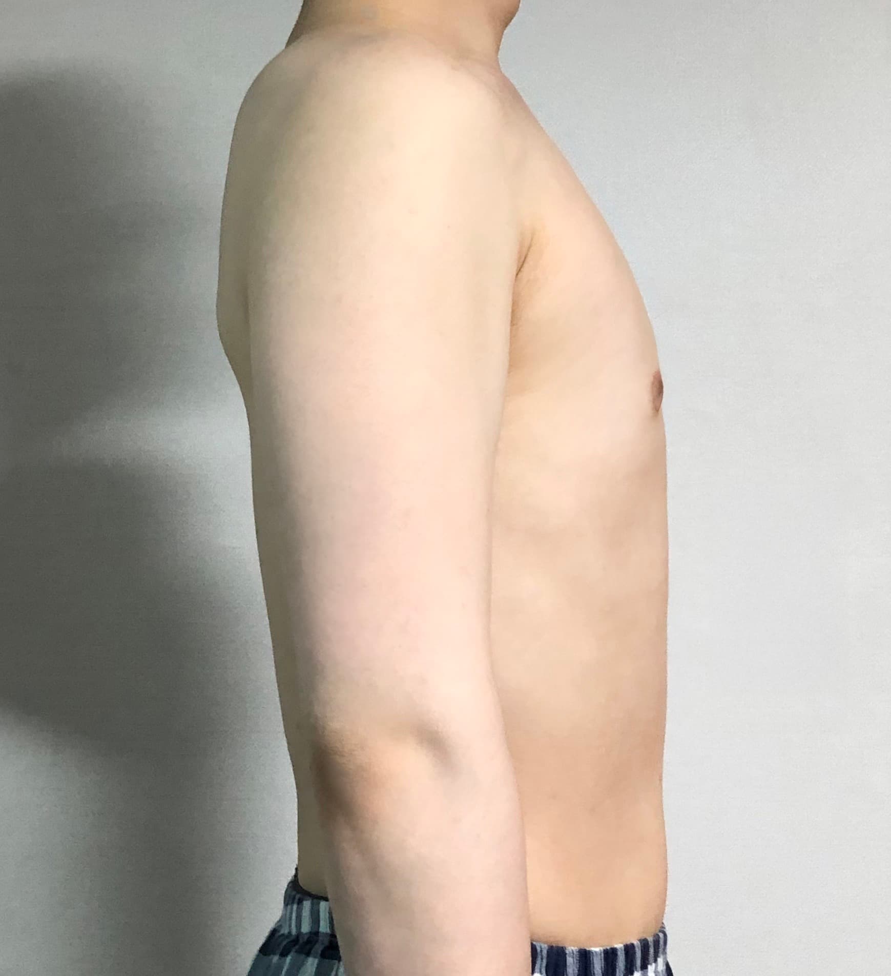 라랄르라님의 시술후기