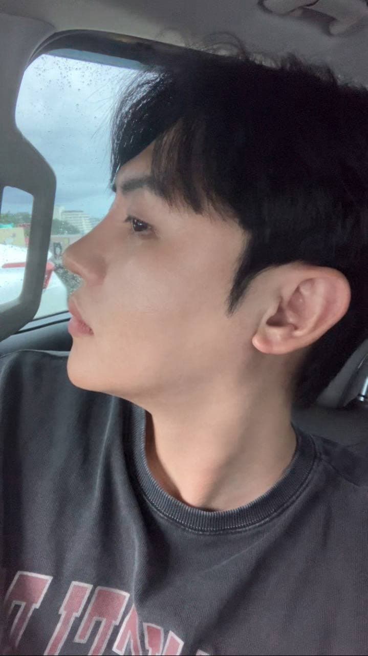 허쉬촠님의 시술후기