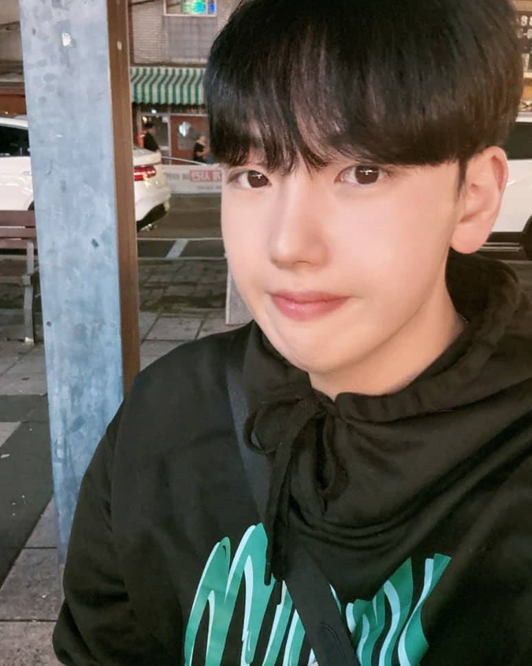 이브븡님의 시술후기