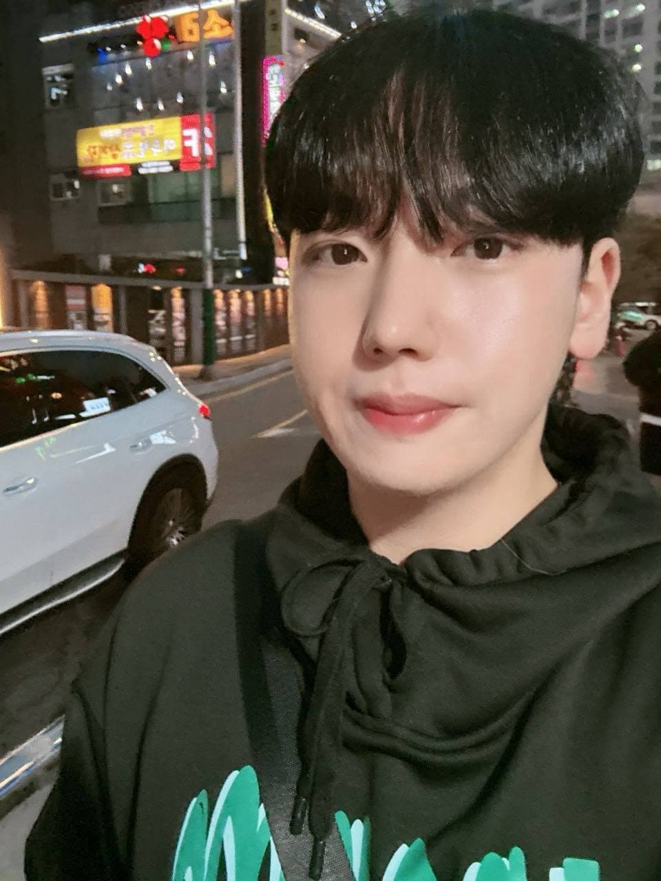 이브븡님의 시술후기