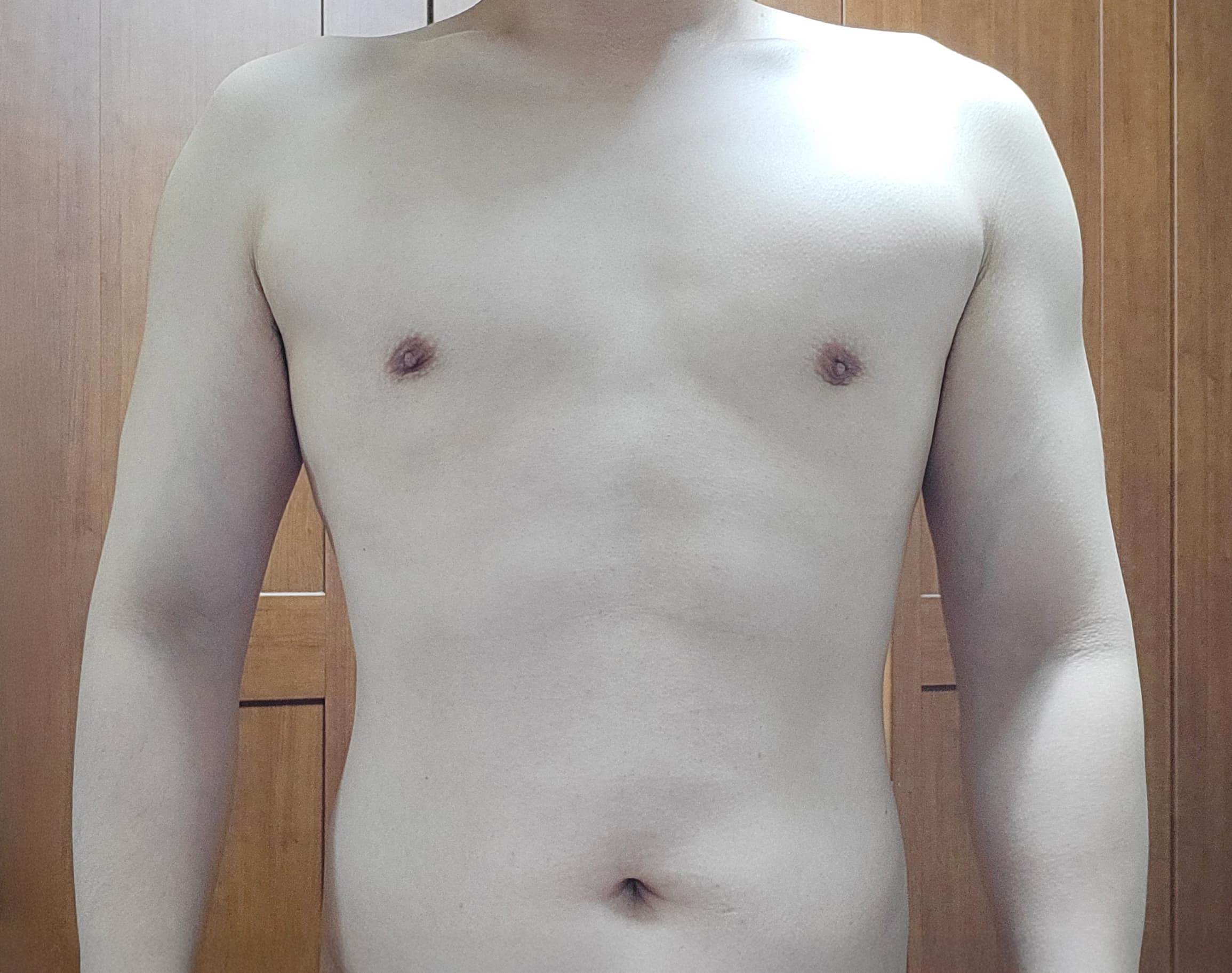 가을하느을님의 시술후기