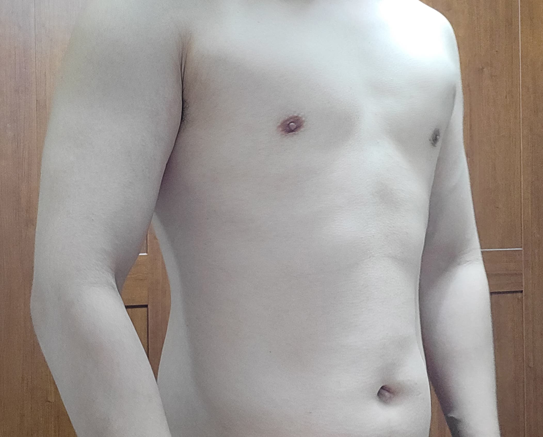 가을하느을님의 시술후기