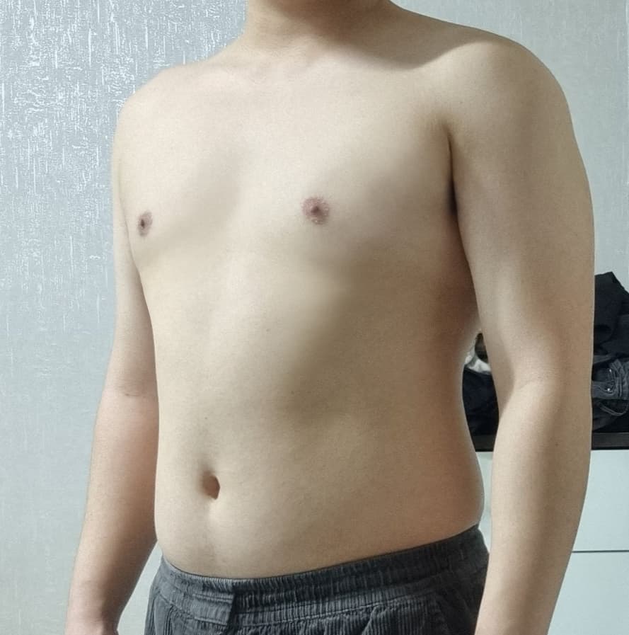 주니닌님의 시술후기