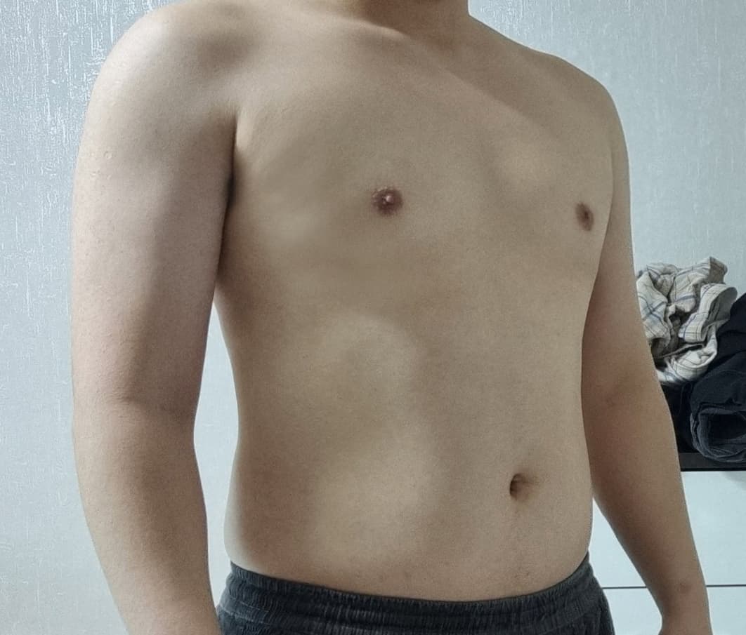 주니닌님의 시술후기