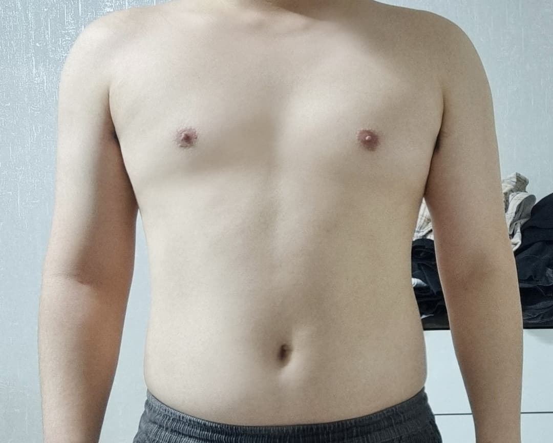 주니닌님의 시술후기