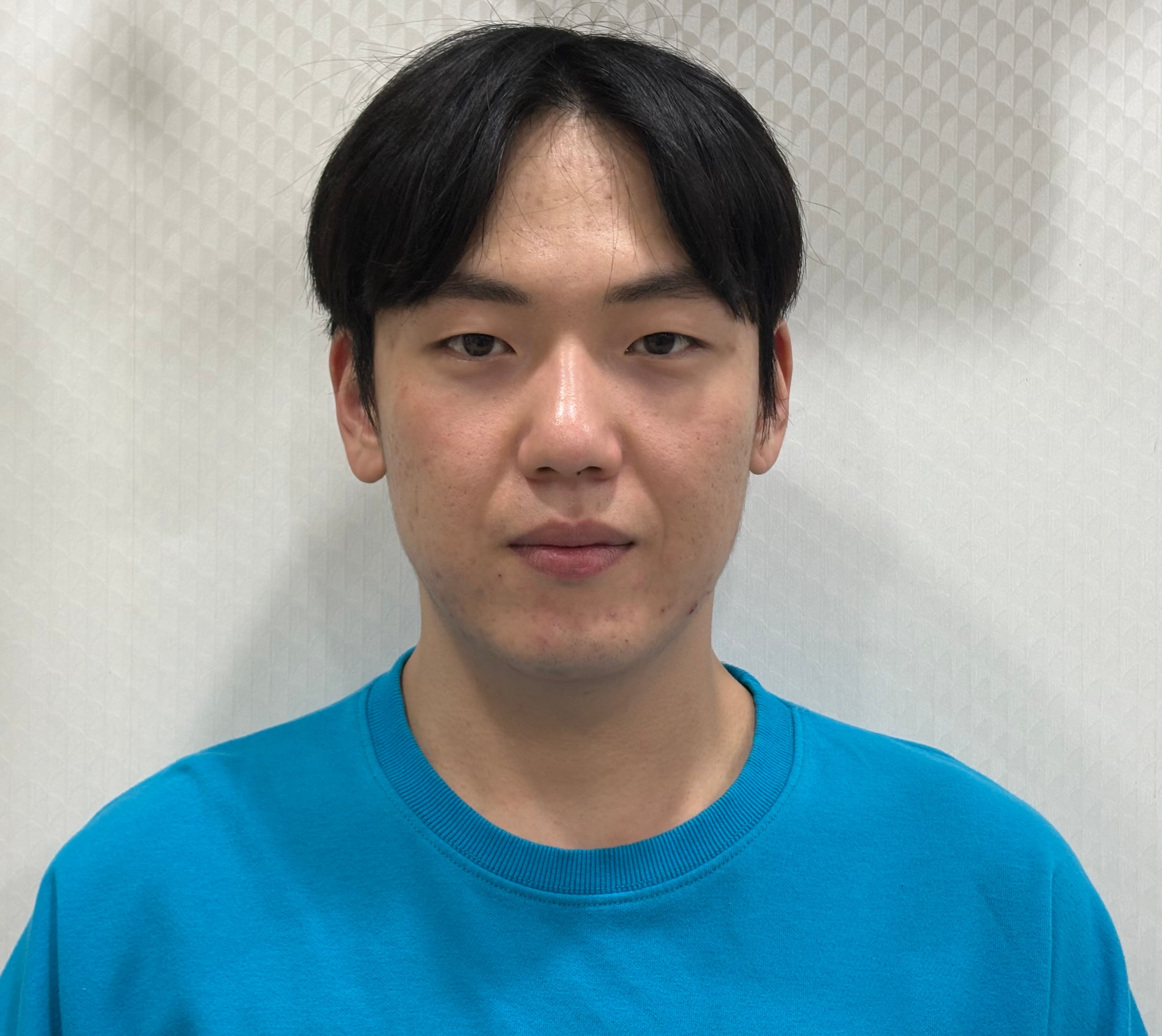 이브븡님의 시술후기