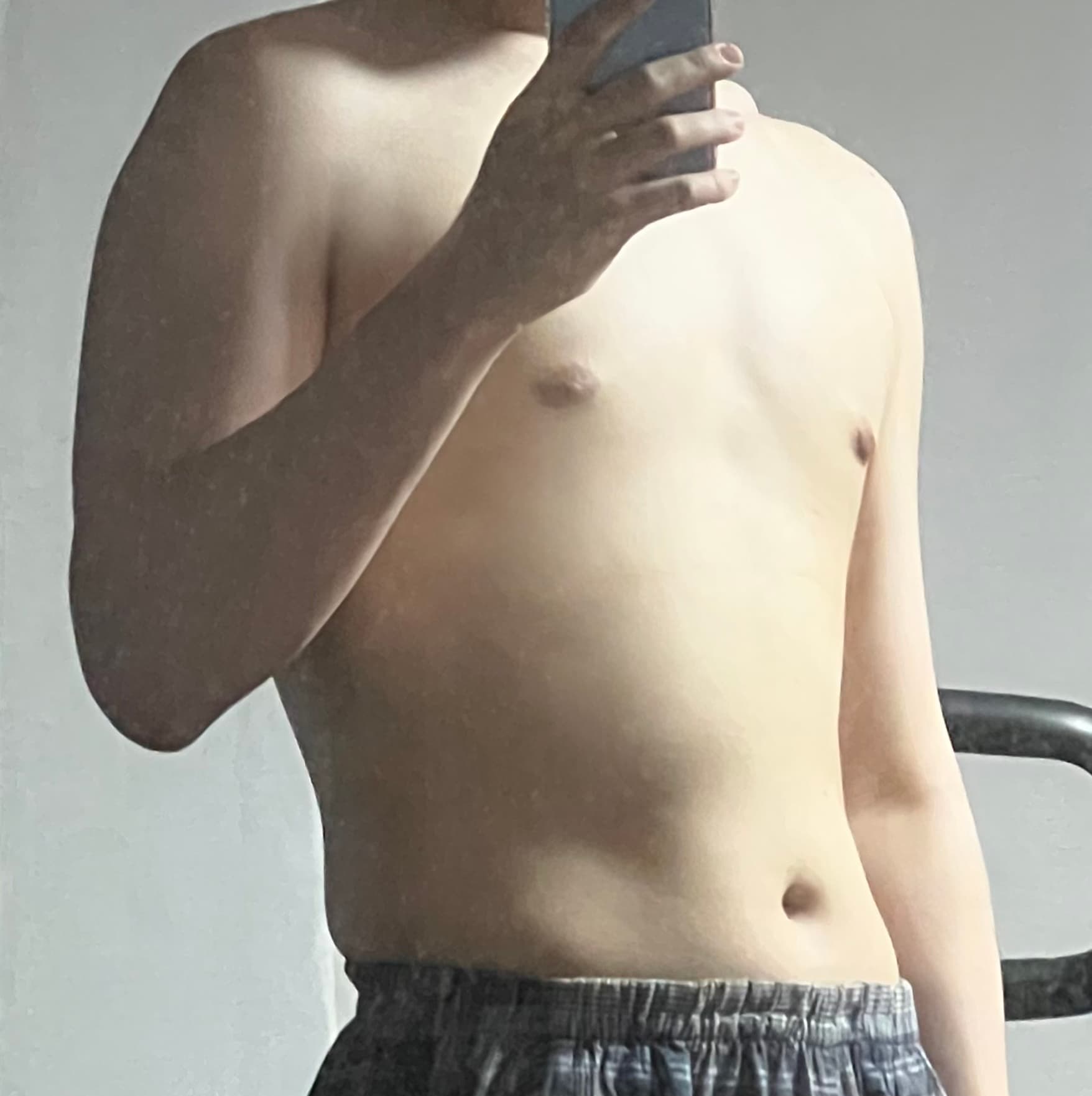 라랄르라님의 시술후기