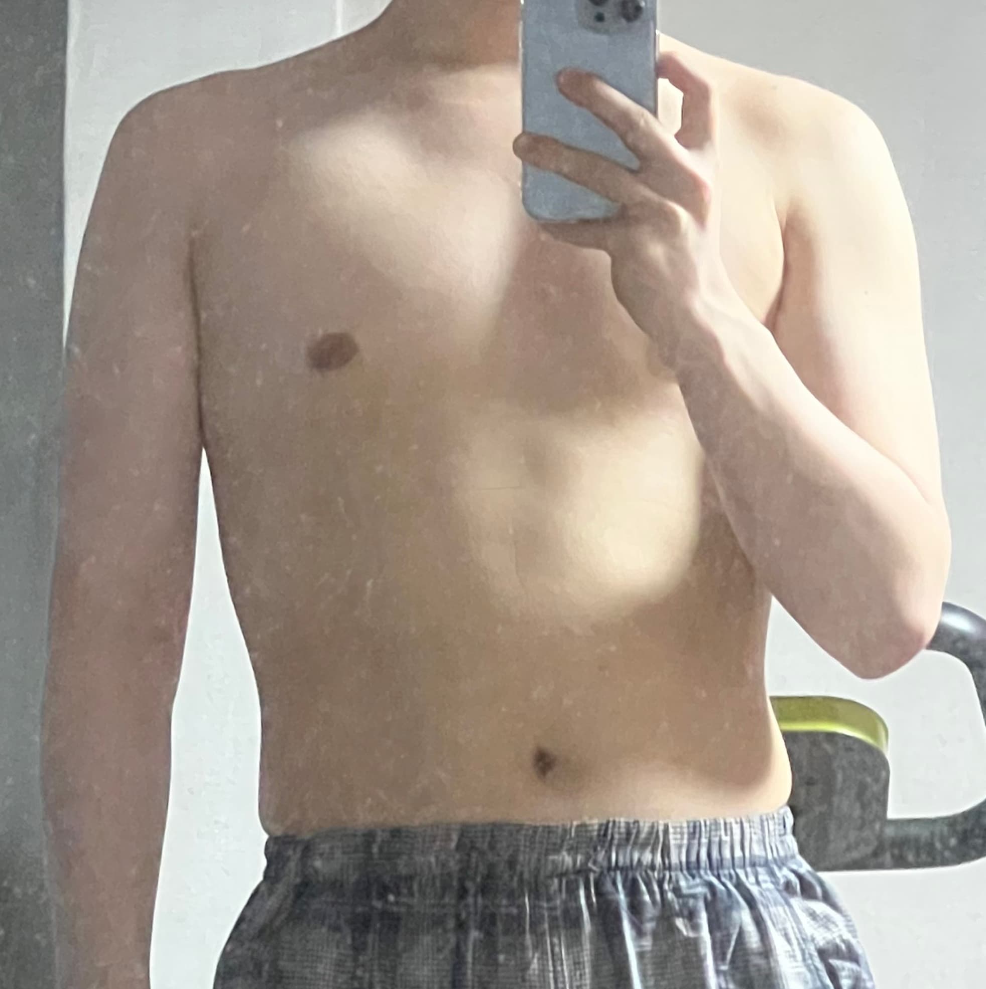 라랄르라님의 시술후기