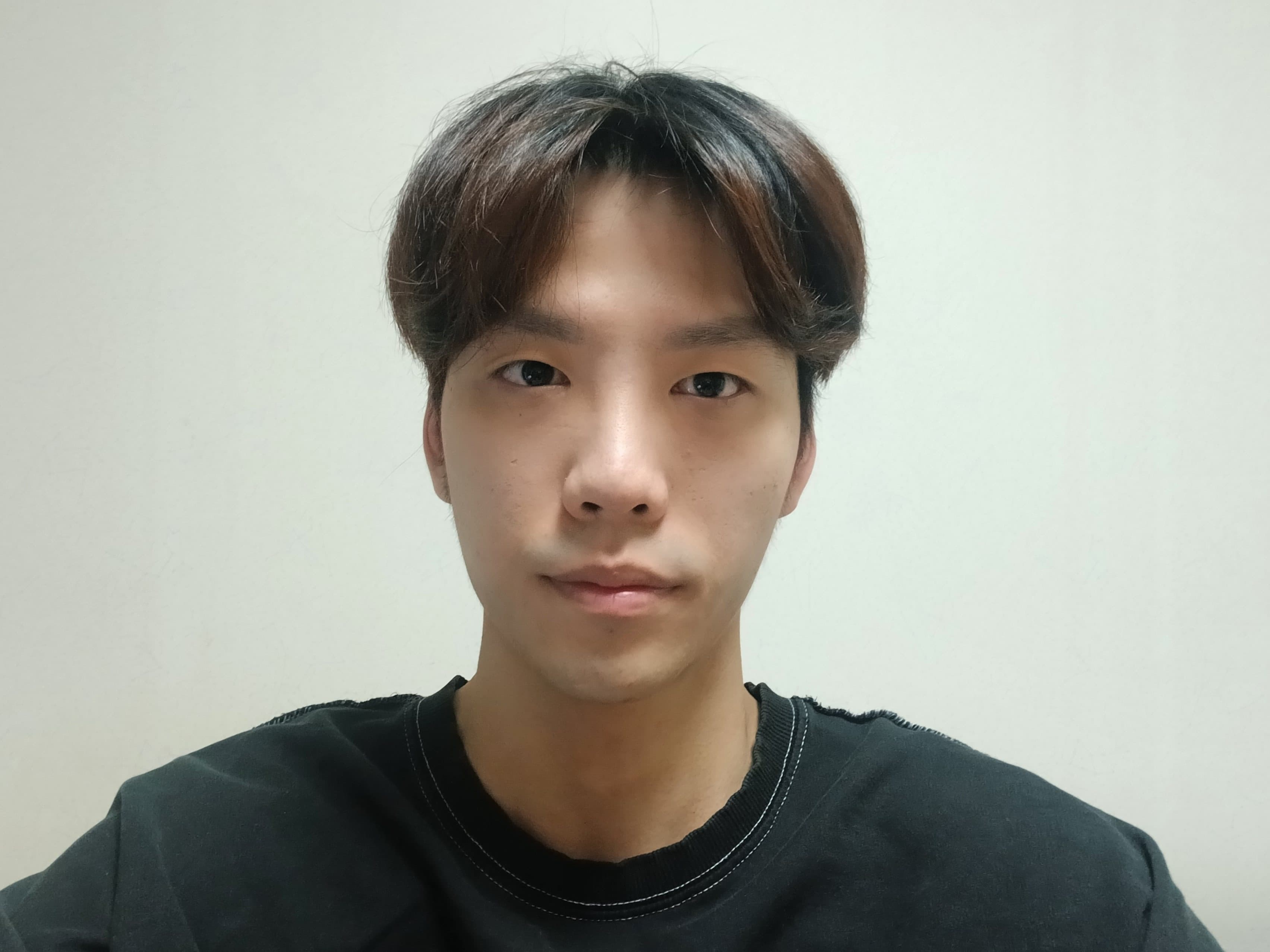 졍이님의 시술후기