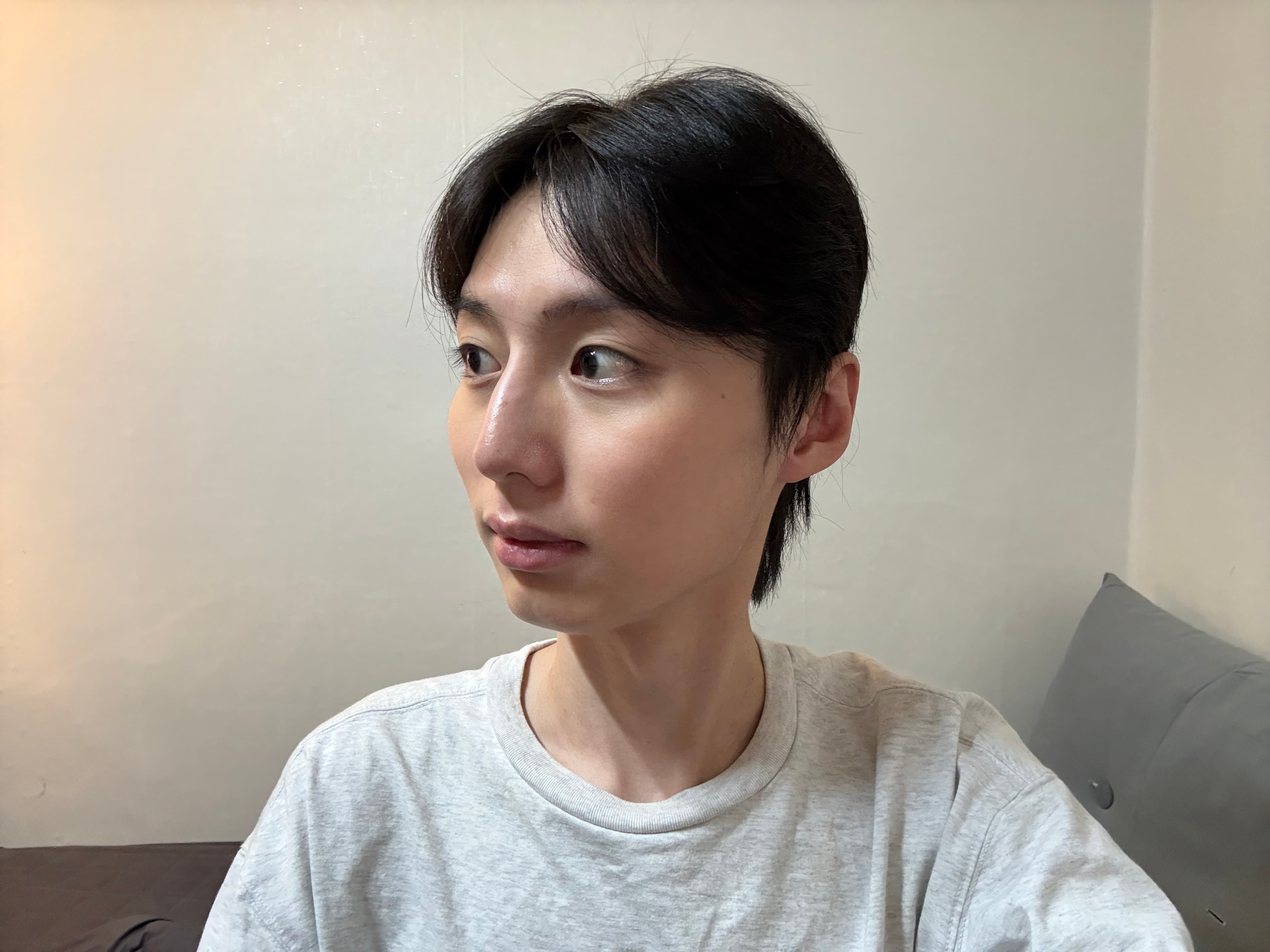 크리쑤님의 시술후기