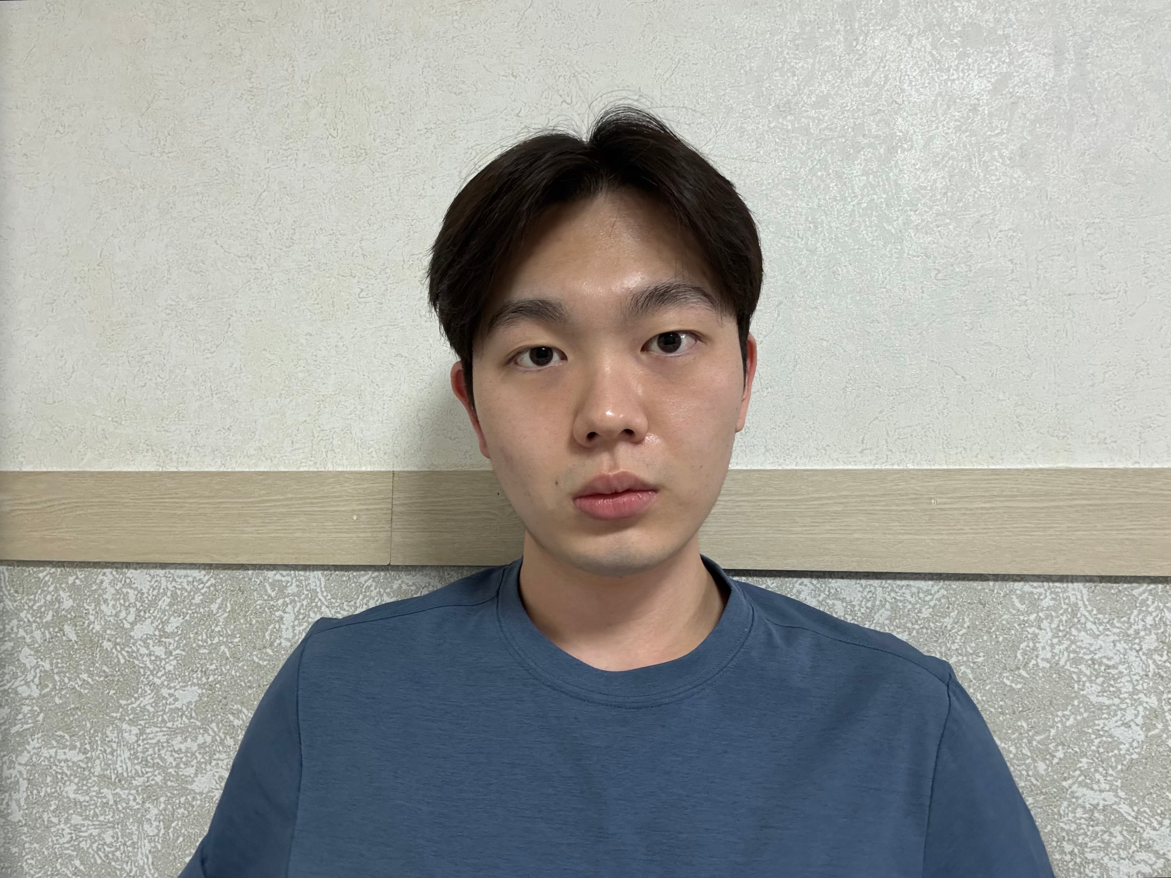 칠팔구장이님의 시술후기