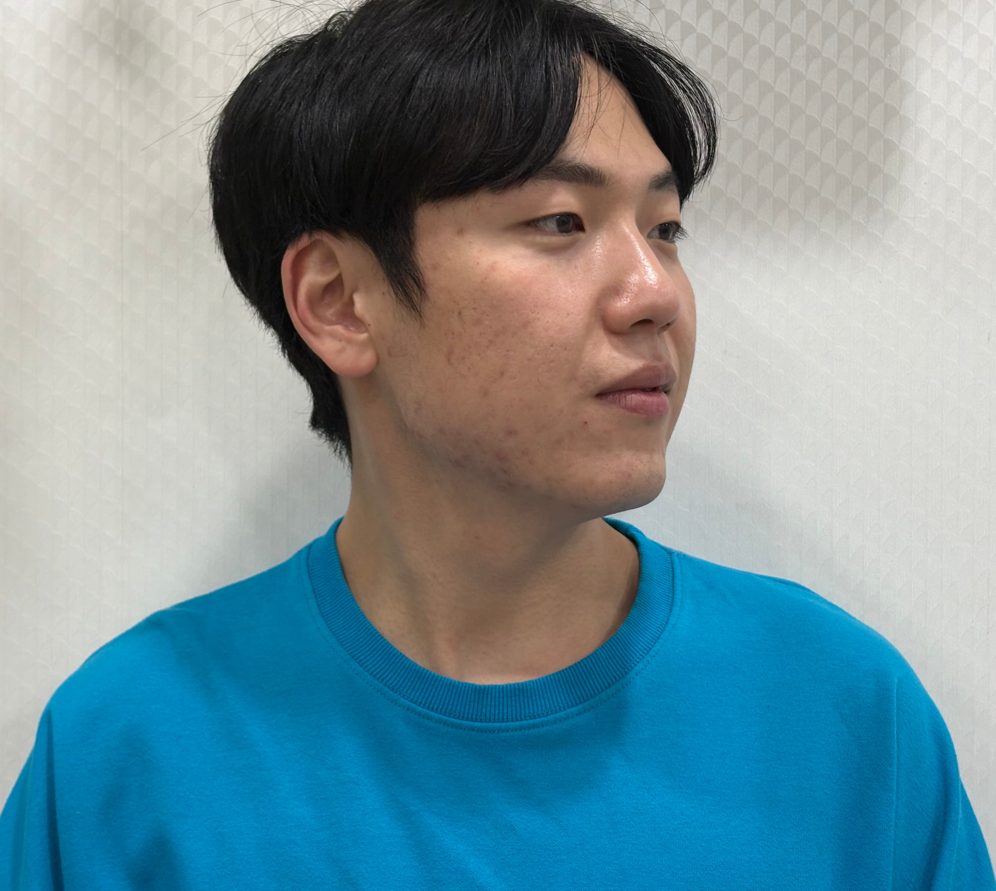 이브븡님의 시술후기