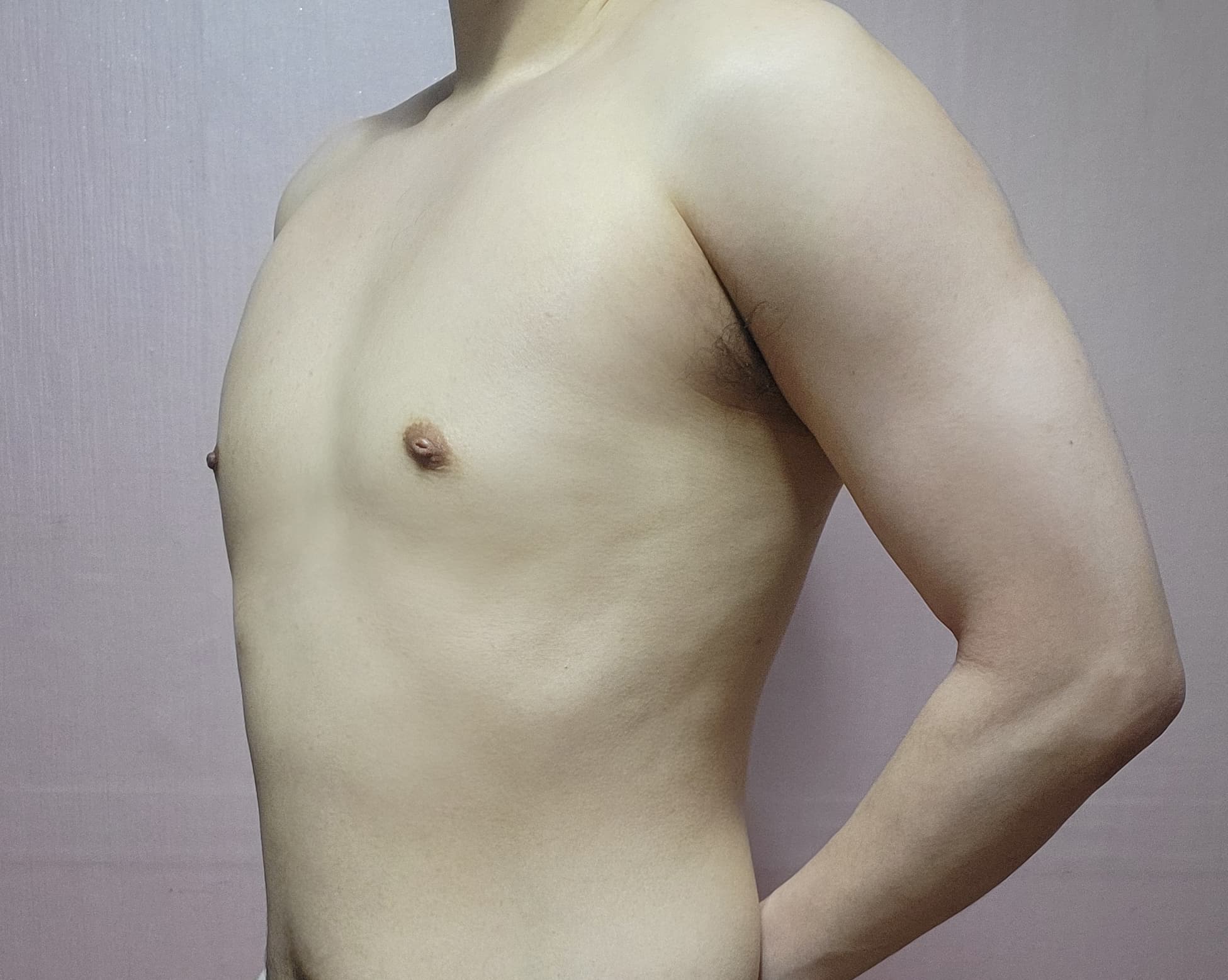 솔솔바람이님의 시술후기