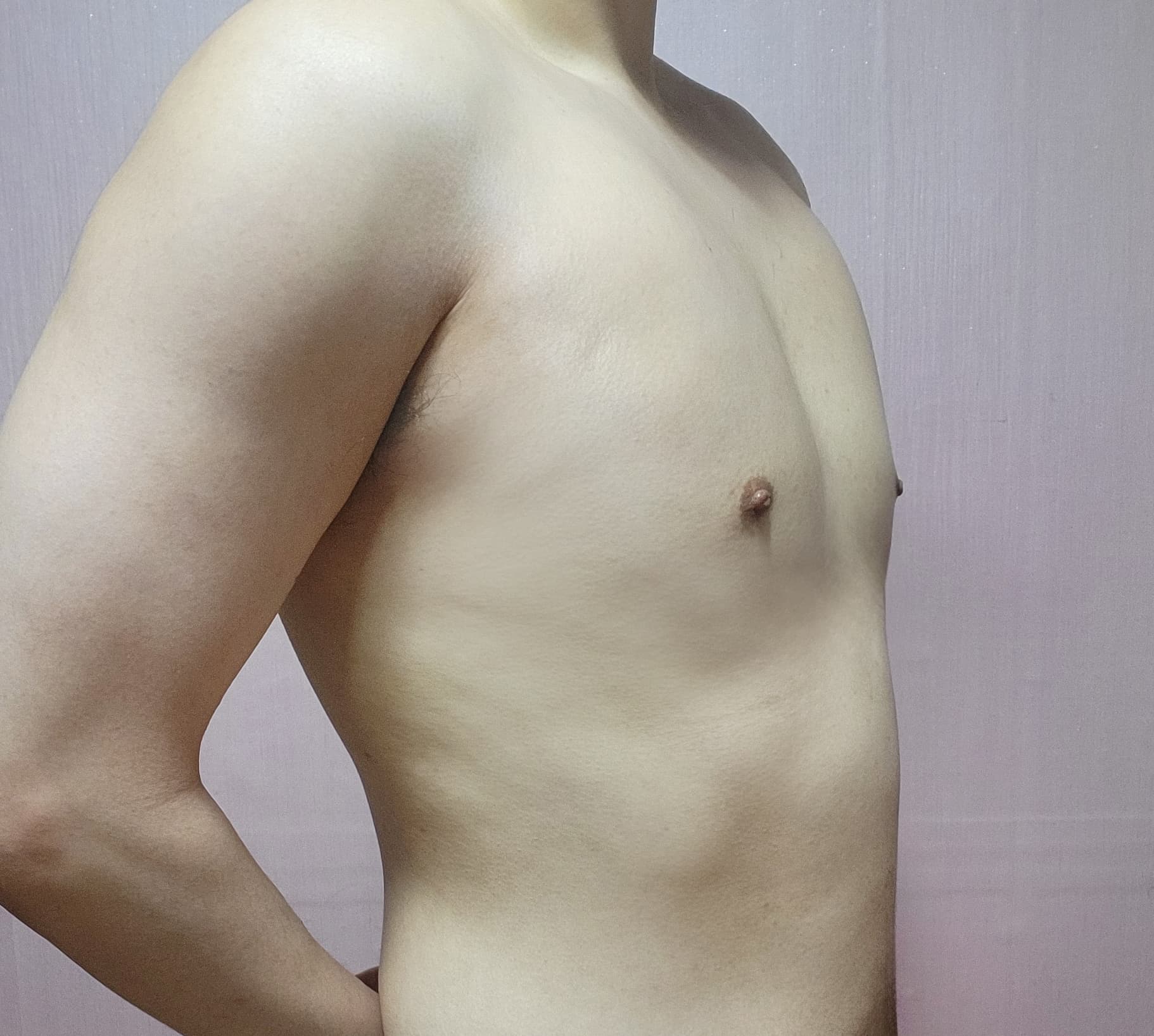 솔솔바람이님의 시술후기