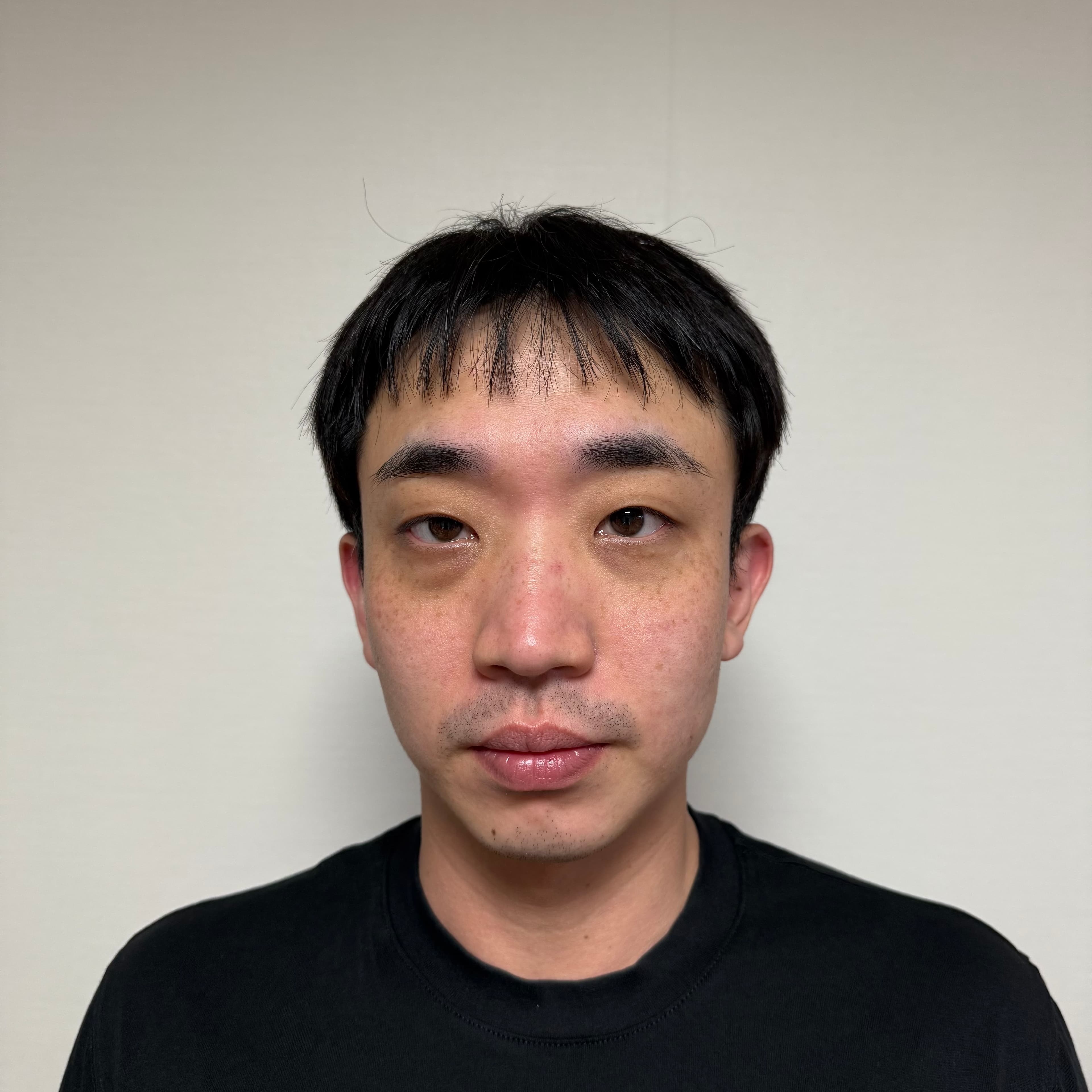 하이덪님의 시술후기