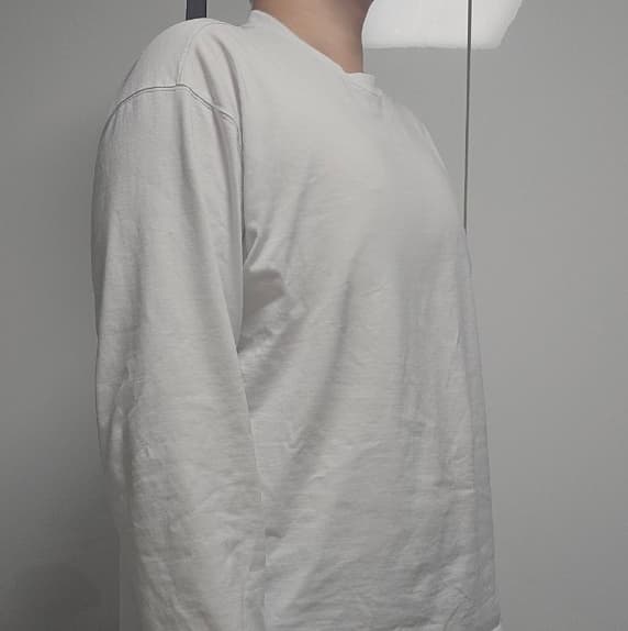 설아3님의 시술후기