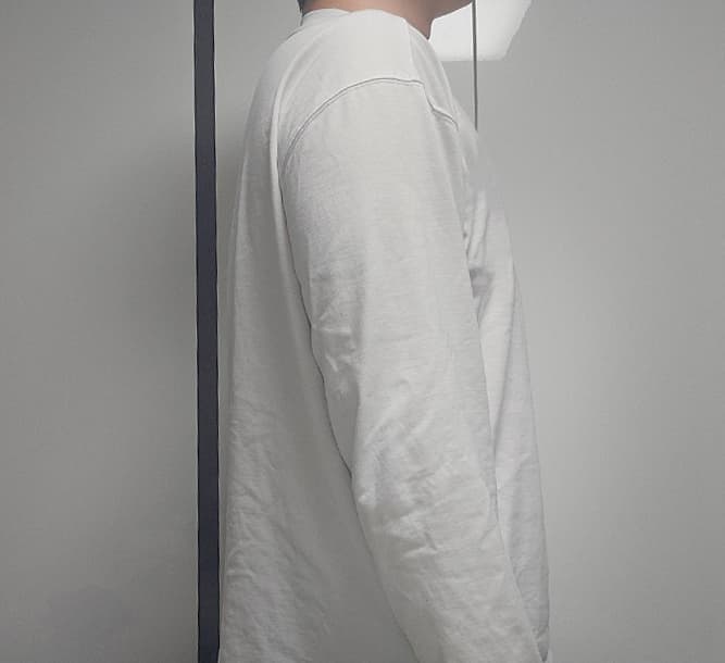 설아3님의 시술후기