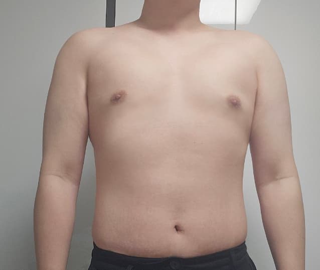 설아3님의 시술후기