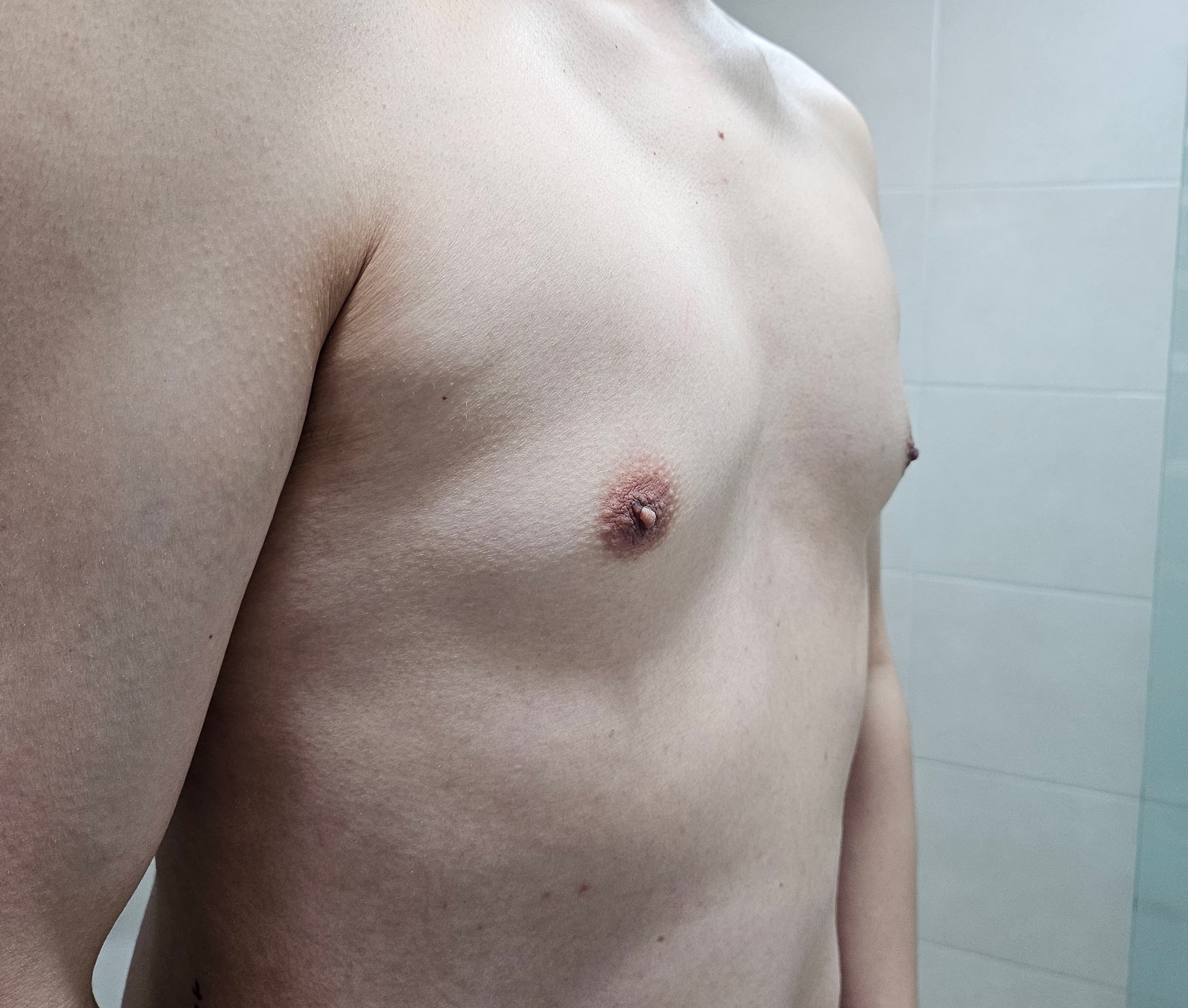 K46763568592601022257님의 시술후기