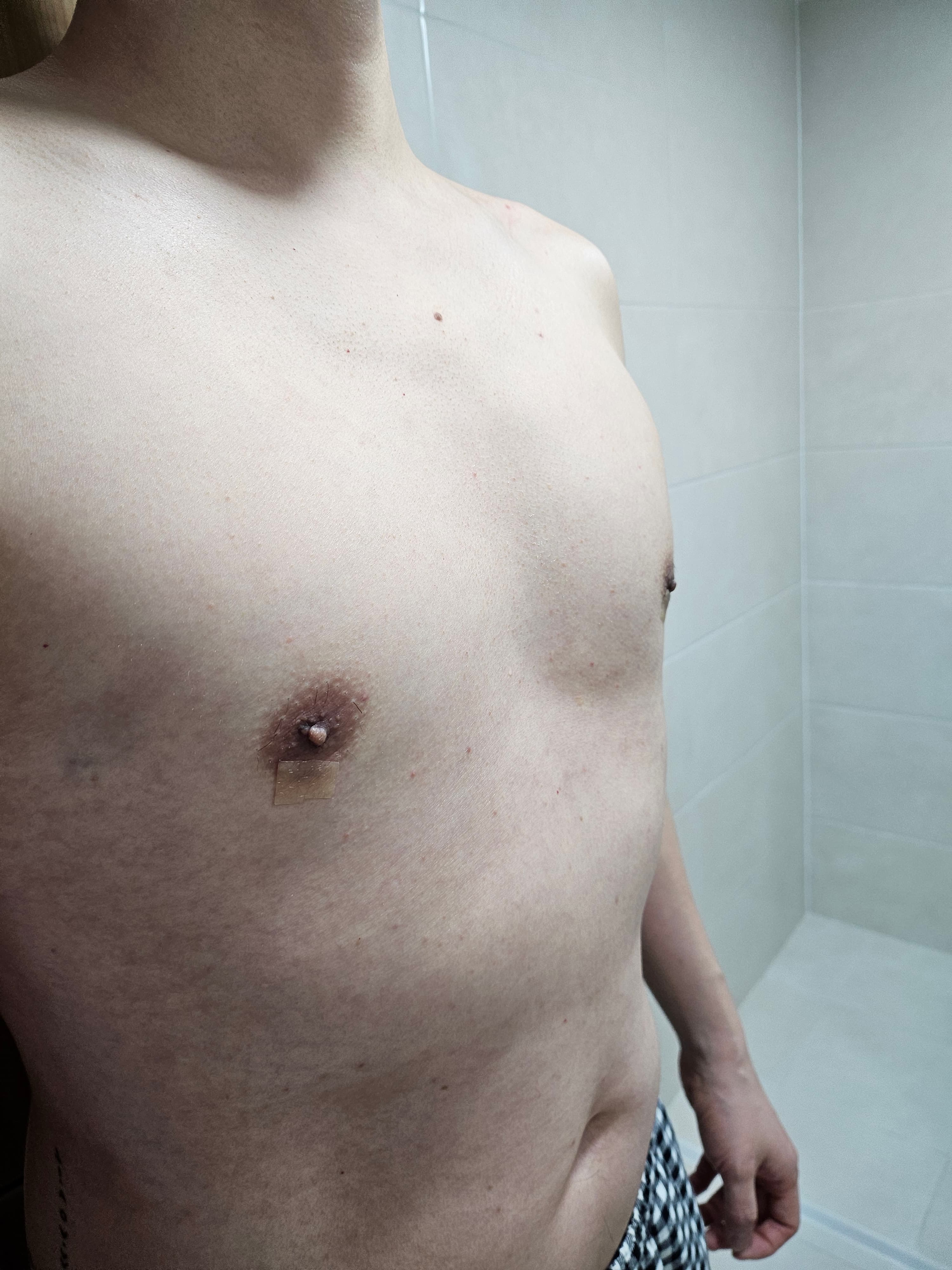 K46763568592601022257님의 시술후기