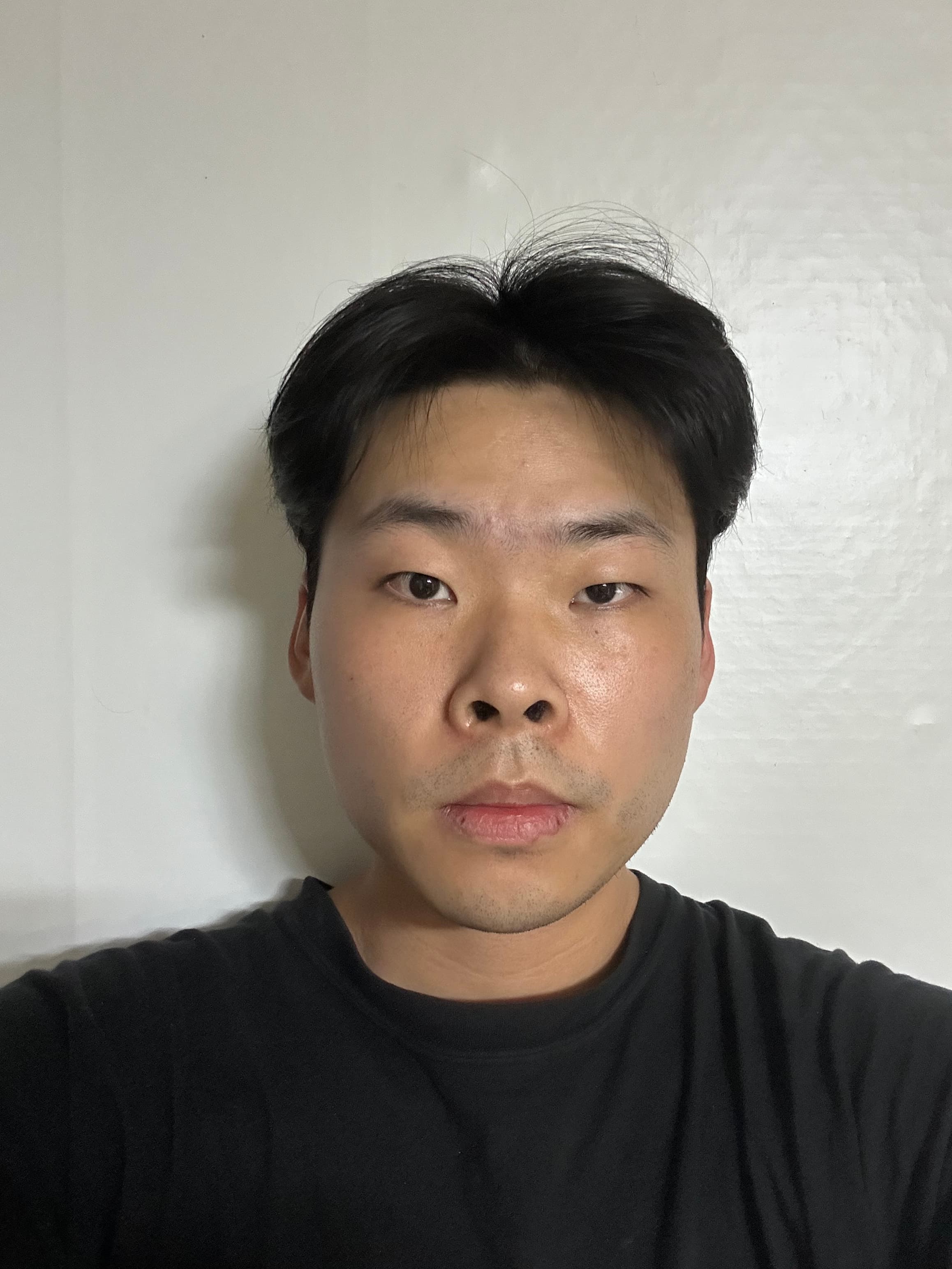 장후나링님의 시술후기