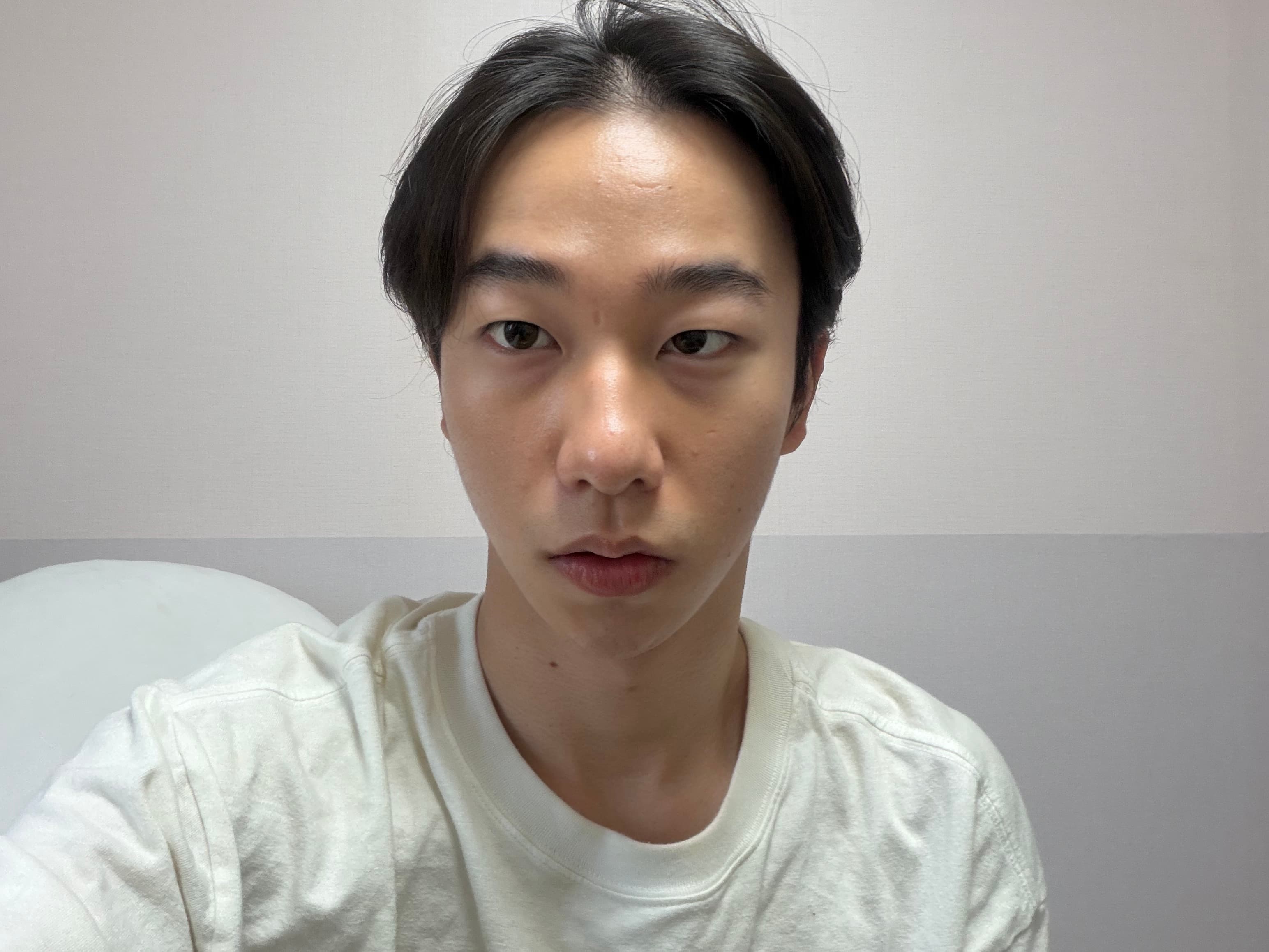 우우닏님의 시술후기