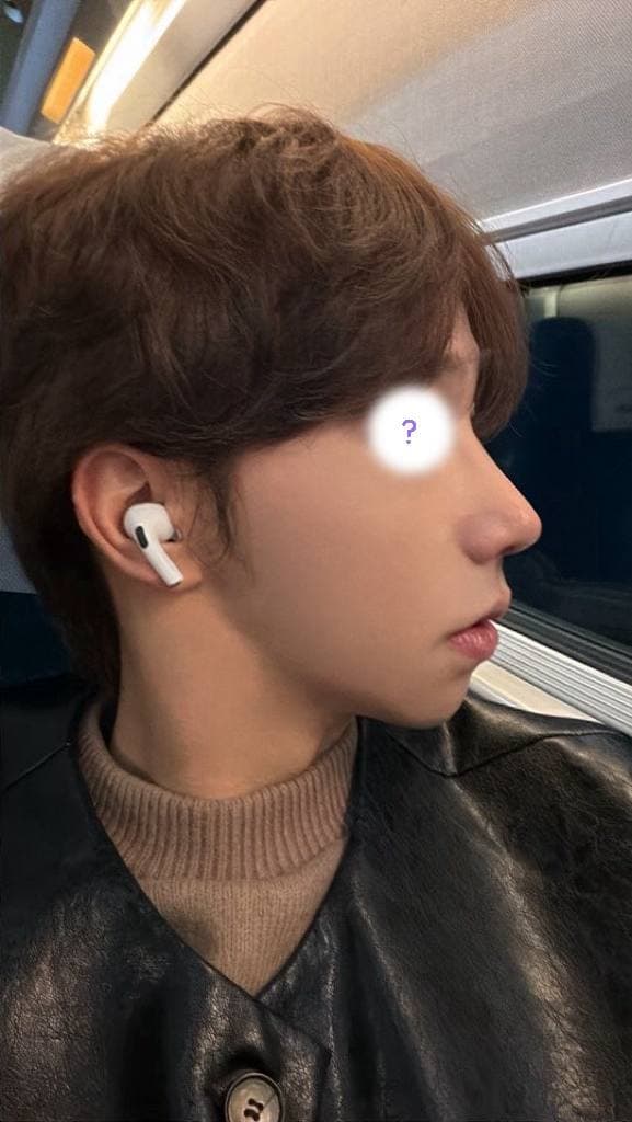 우우닏님의 시술후기