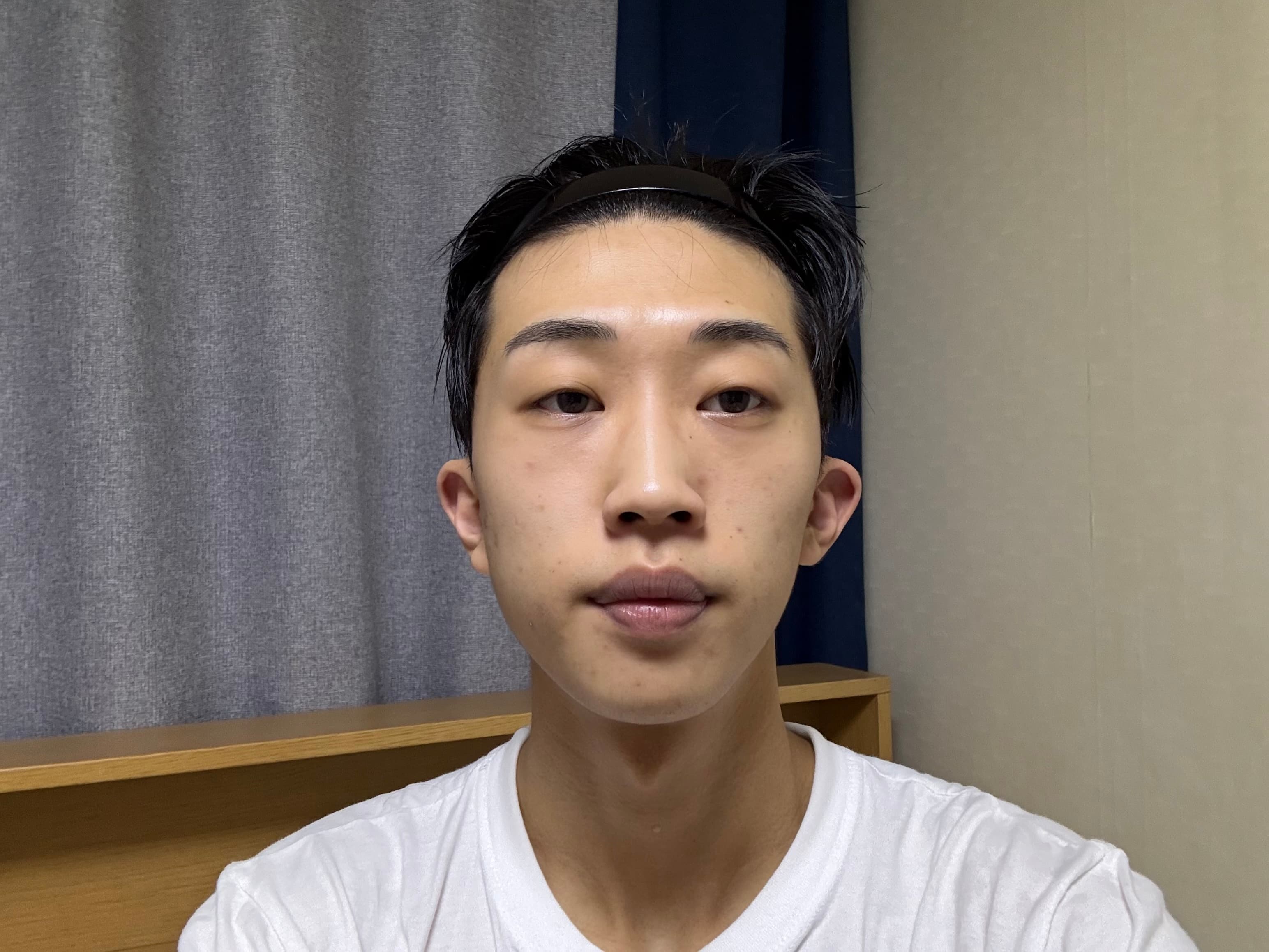 날라다녈님의 시술후기