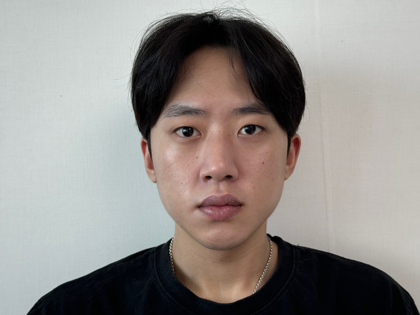 주뉴님의 시술후기