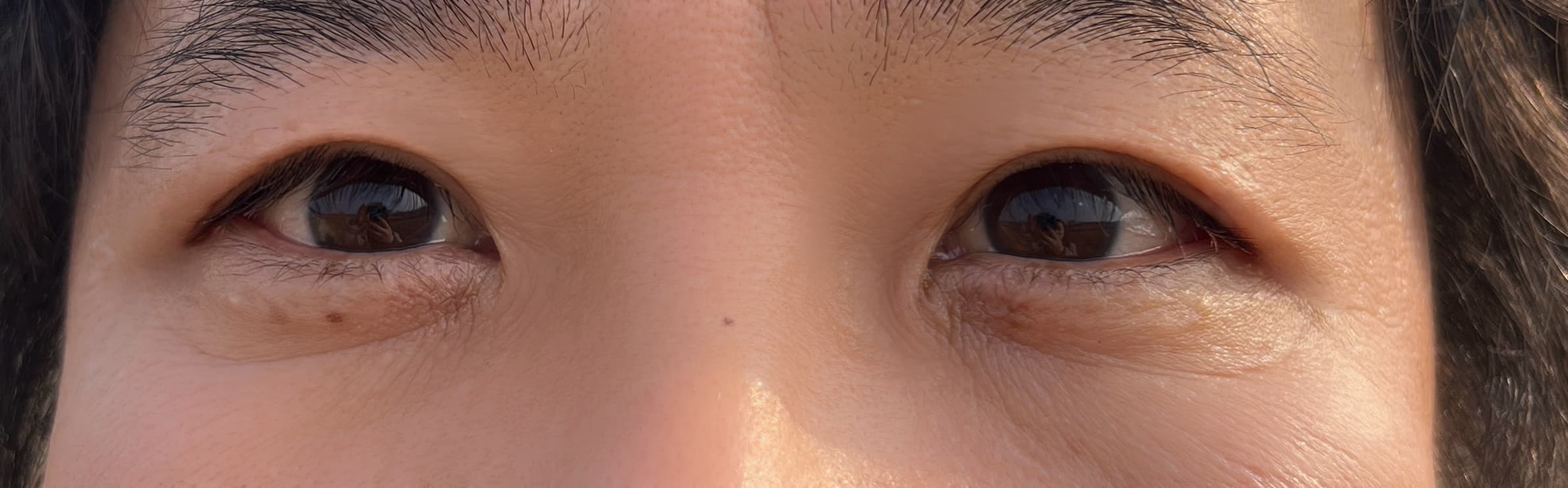 도쿄대재학생님의 시술후기