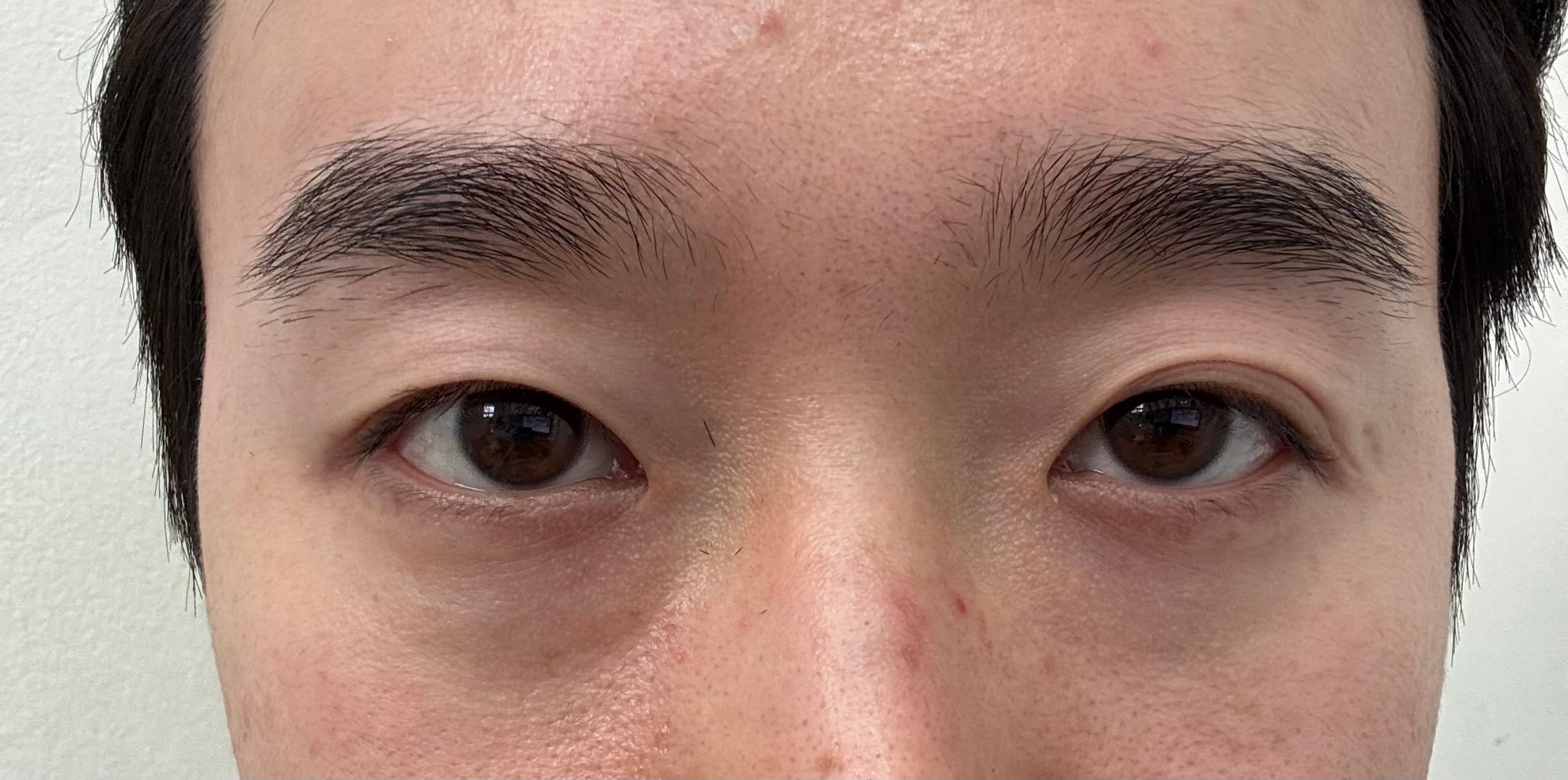 DHNWH님의 시술후기