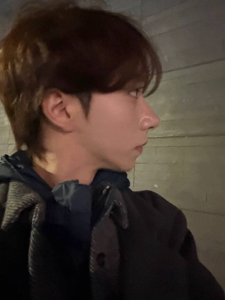 우우닏님의 시술후기