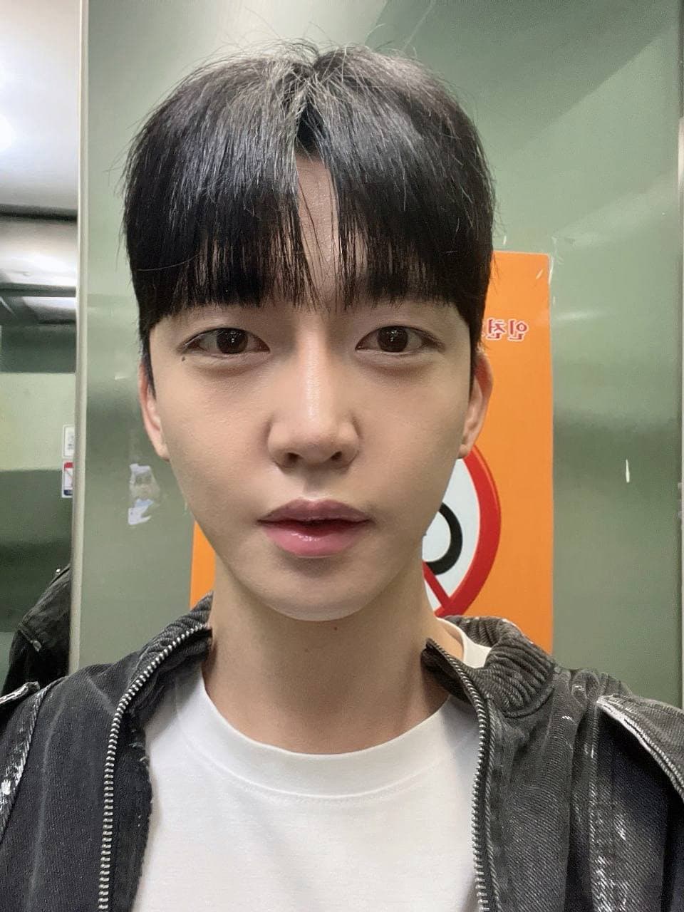 가가이기님의 시술후기