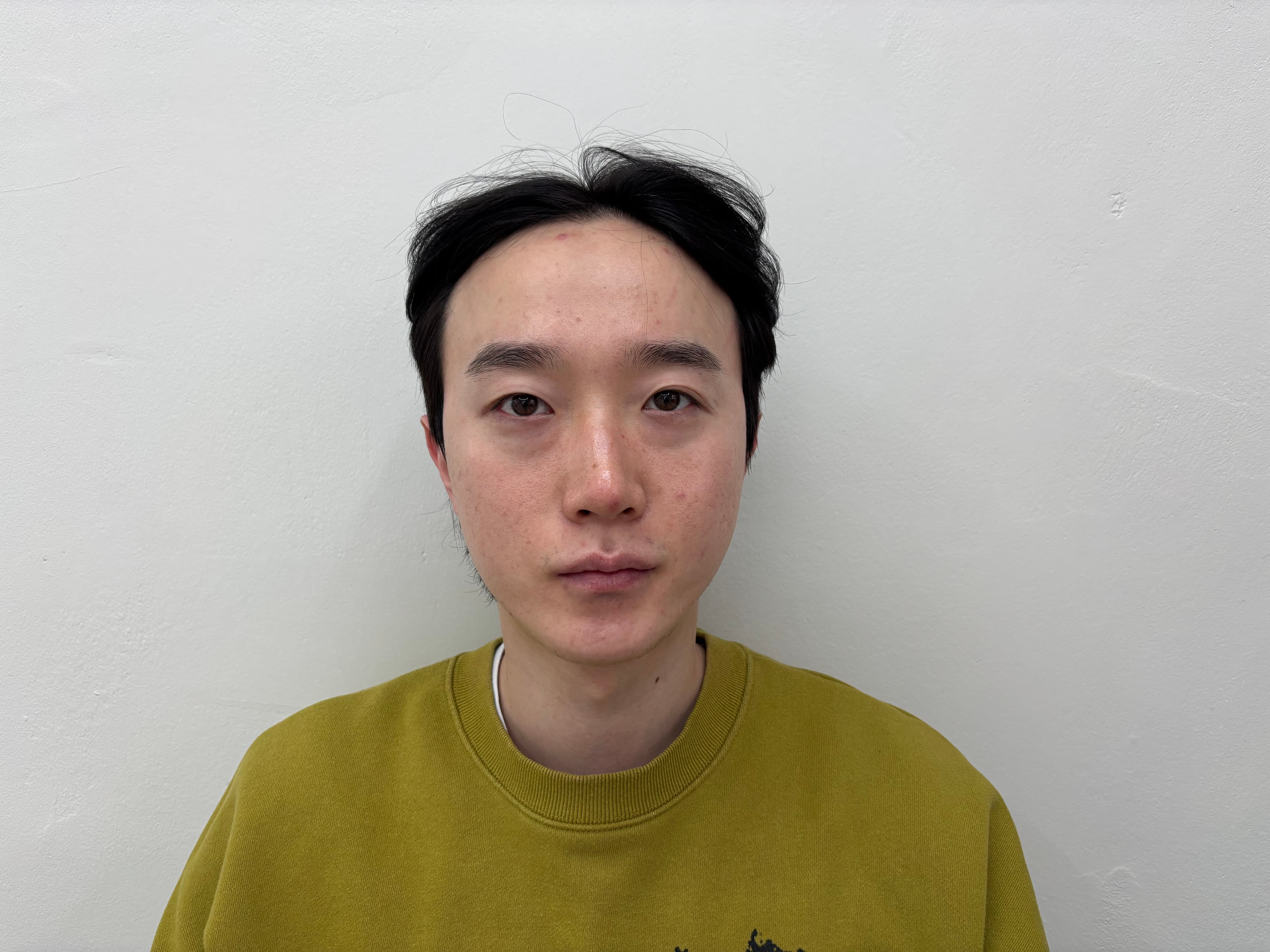 DHNWH님의 시술후기