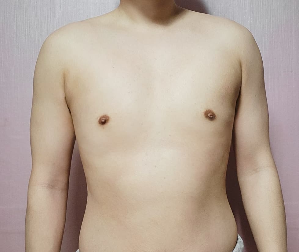 솔솔바람이님의 시술후기