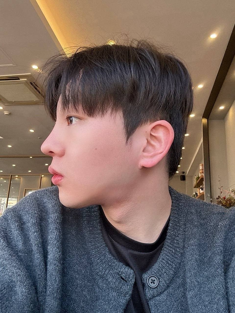 칠팔구장이님의 시술후기