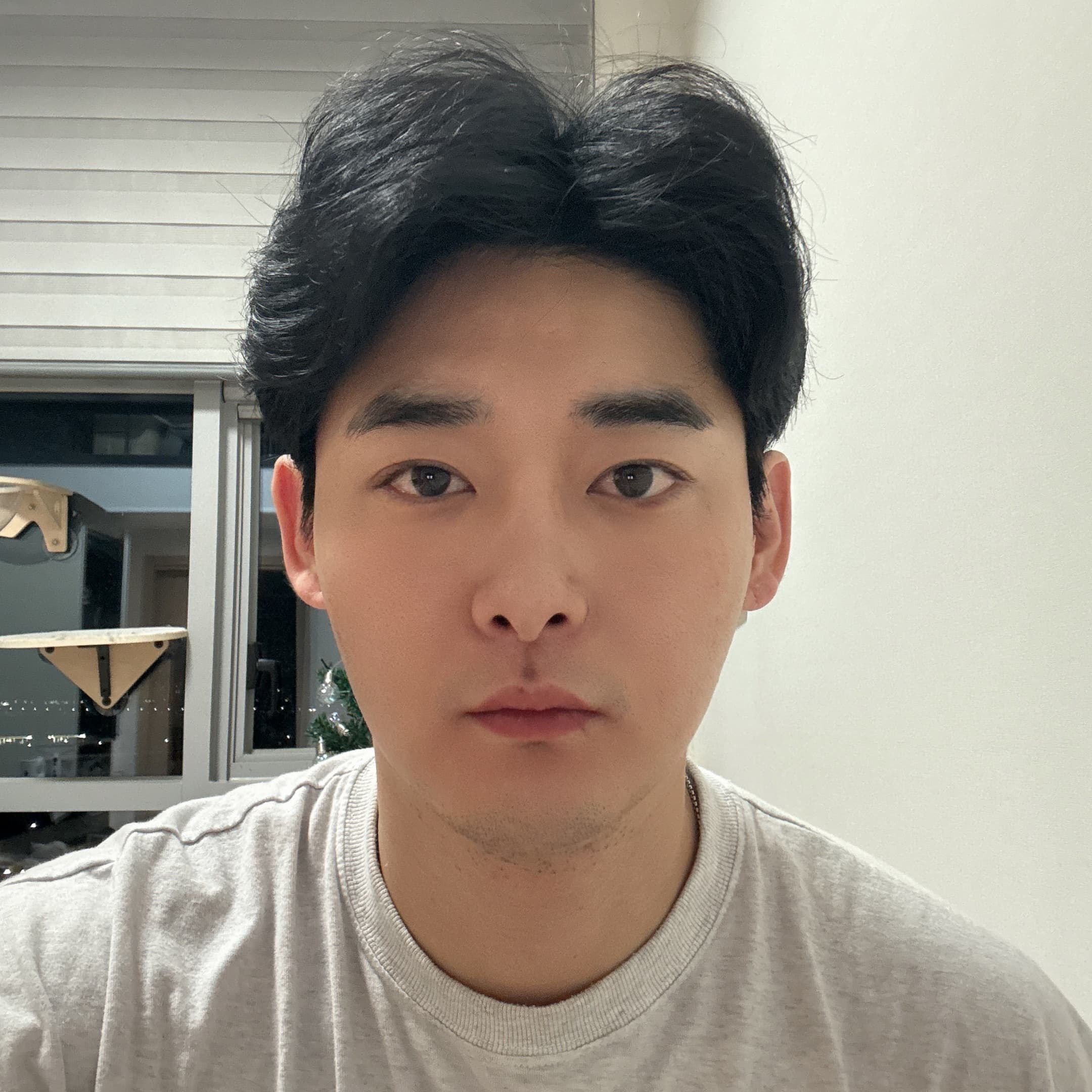 아누리조님의 시술후기