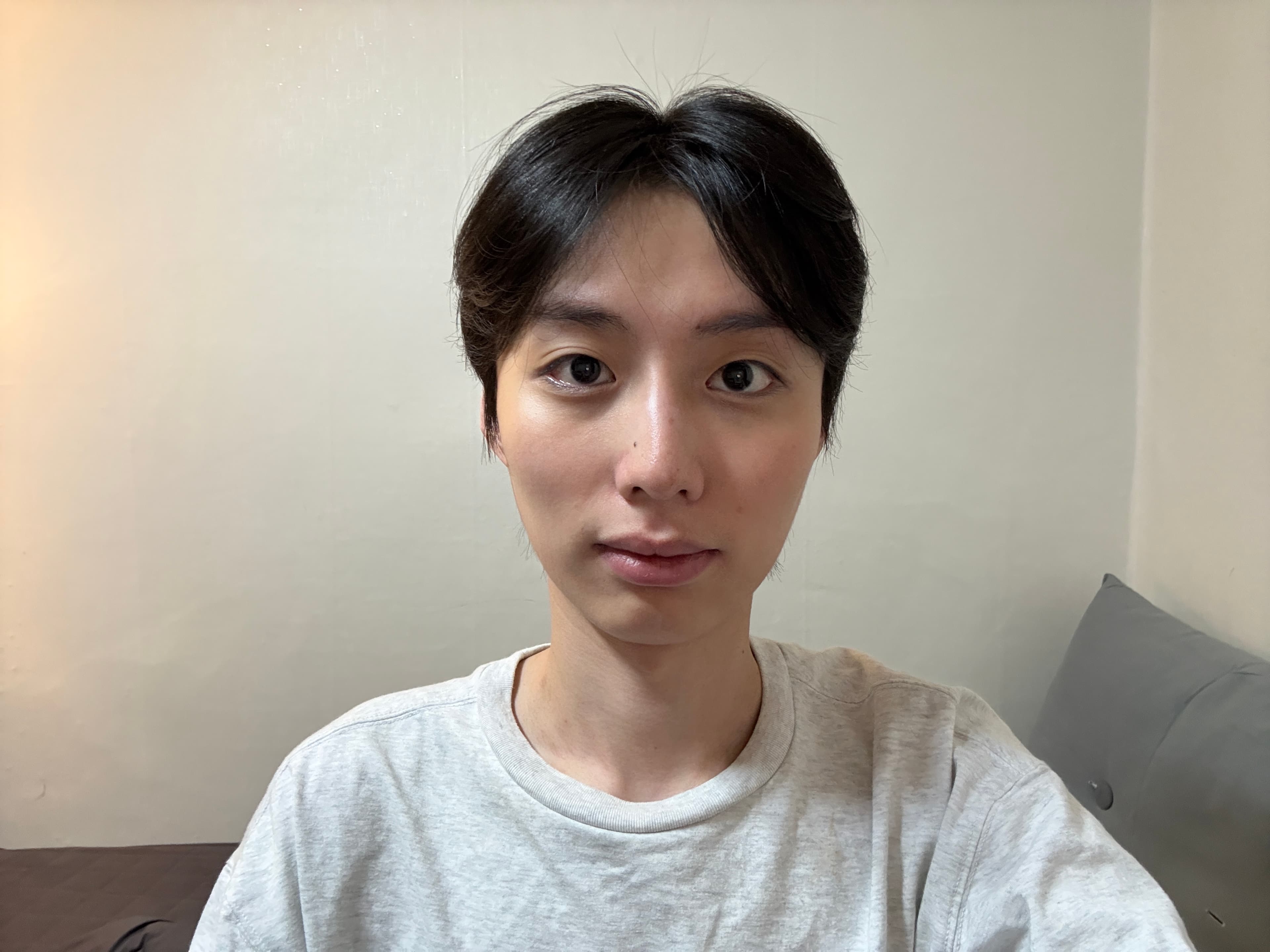 크리쑤님의 시술후기