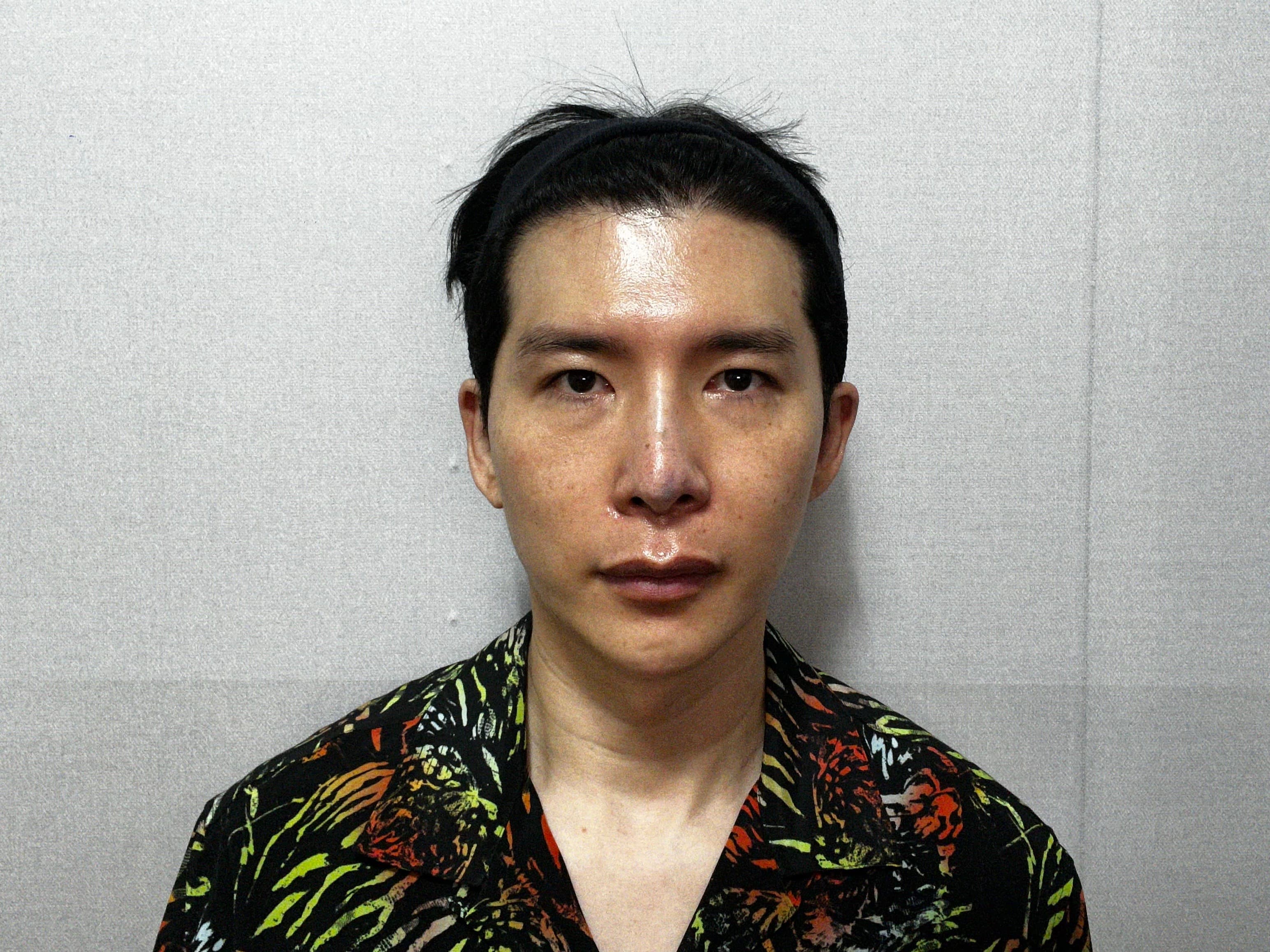 EYDNgj님의 시술후기